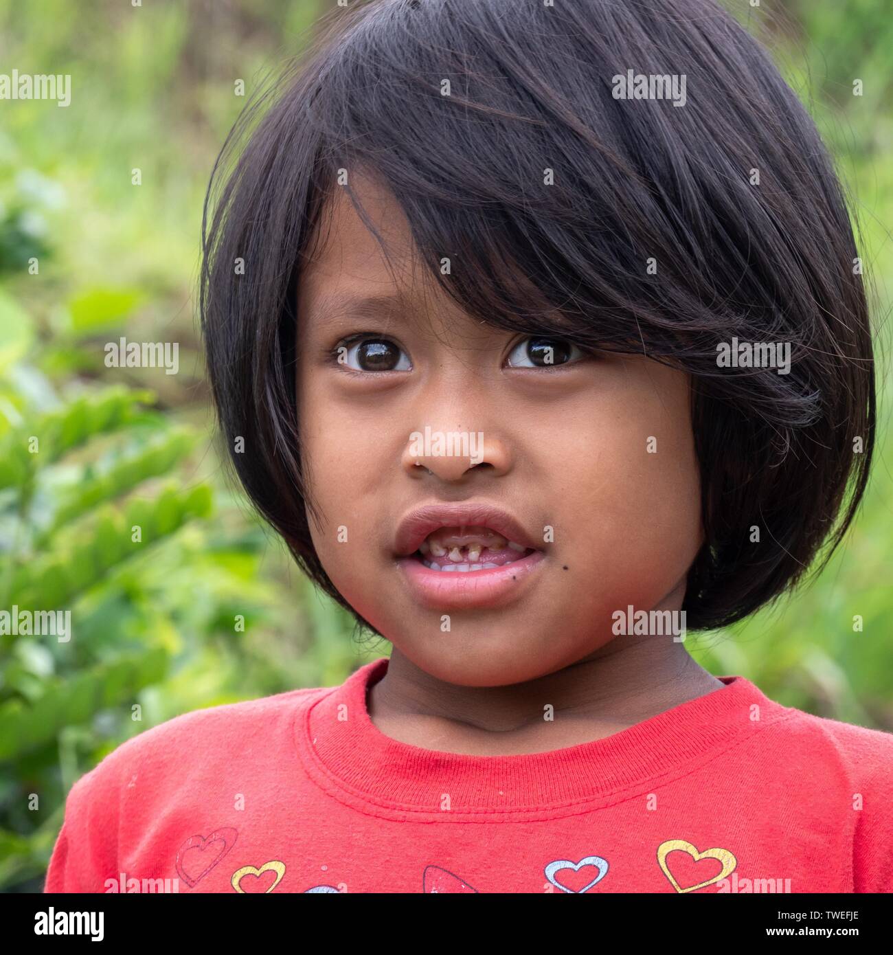 Little girl with bad teeth, portrait, Bali, Indonesia Stock Photo