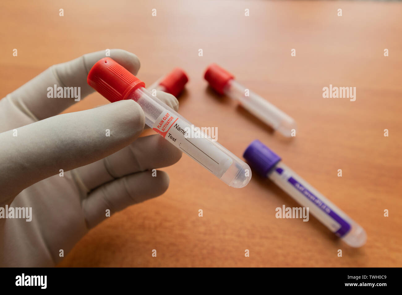 Pro-coagulation Plain Clot Activator blood collection tube,with red plastic stopper held by hand In Laboratory. Stock Photo
