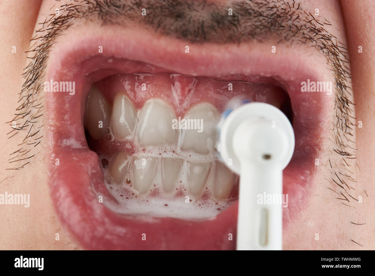 Macro of cleaning teeth with electrical brush head Stock Photo Alamy