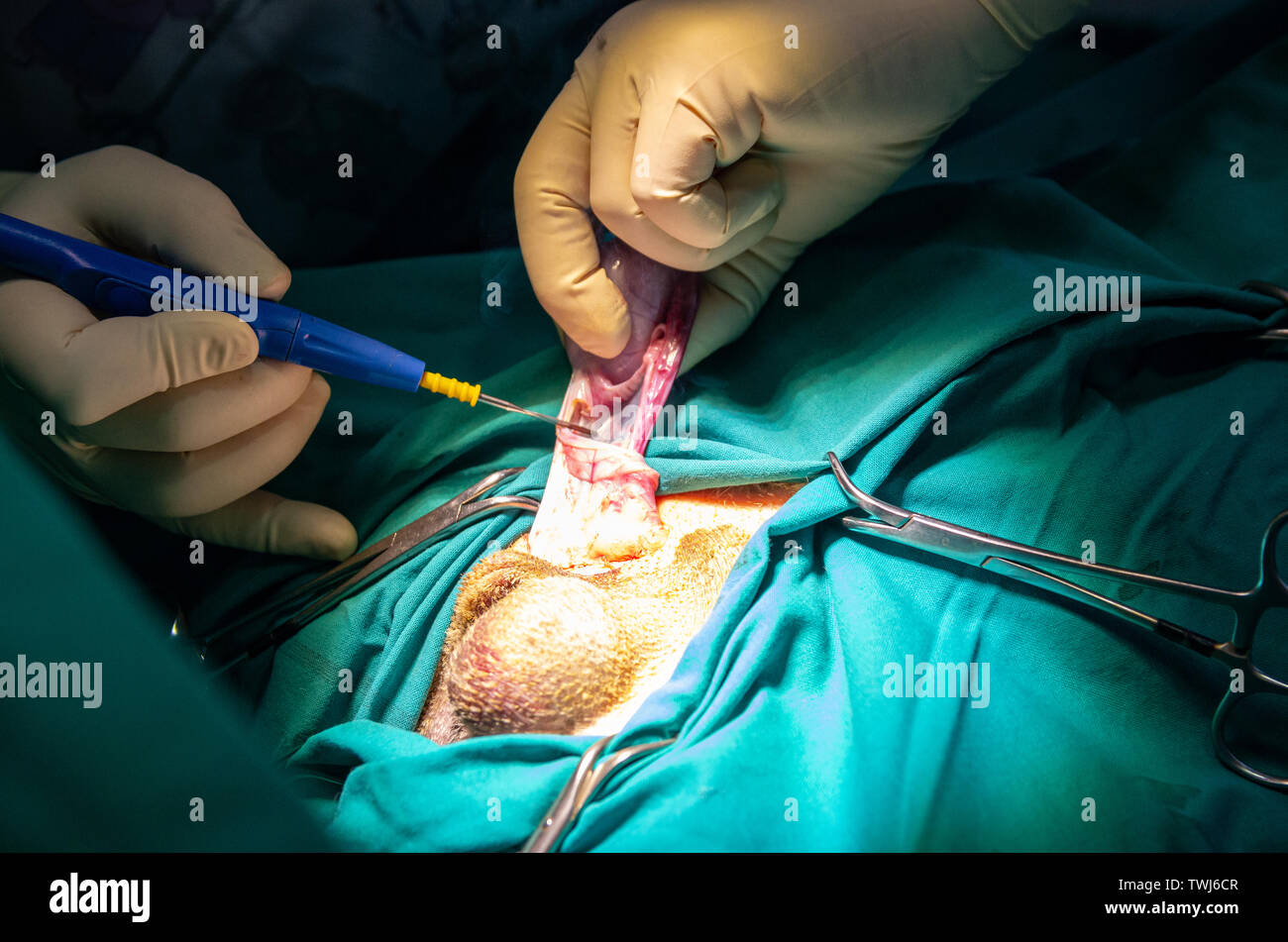 Cutting of a testicular ligament with an electric scalpel in a orchiectomy Stock Photo