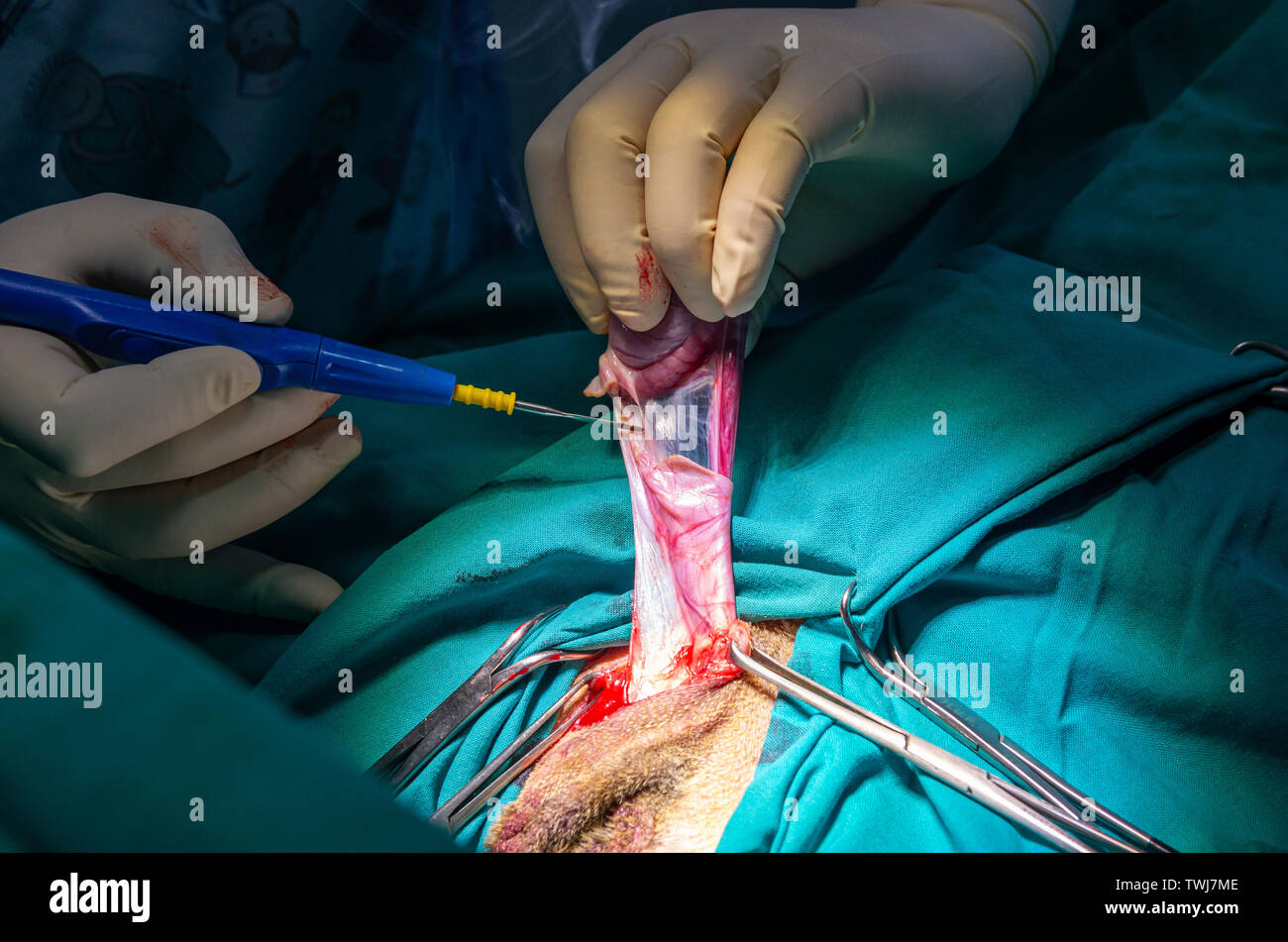 Cutting of a testicular ligament with an electric scalpel in a orchiectomy Stock Photo