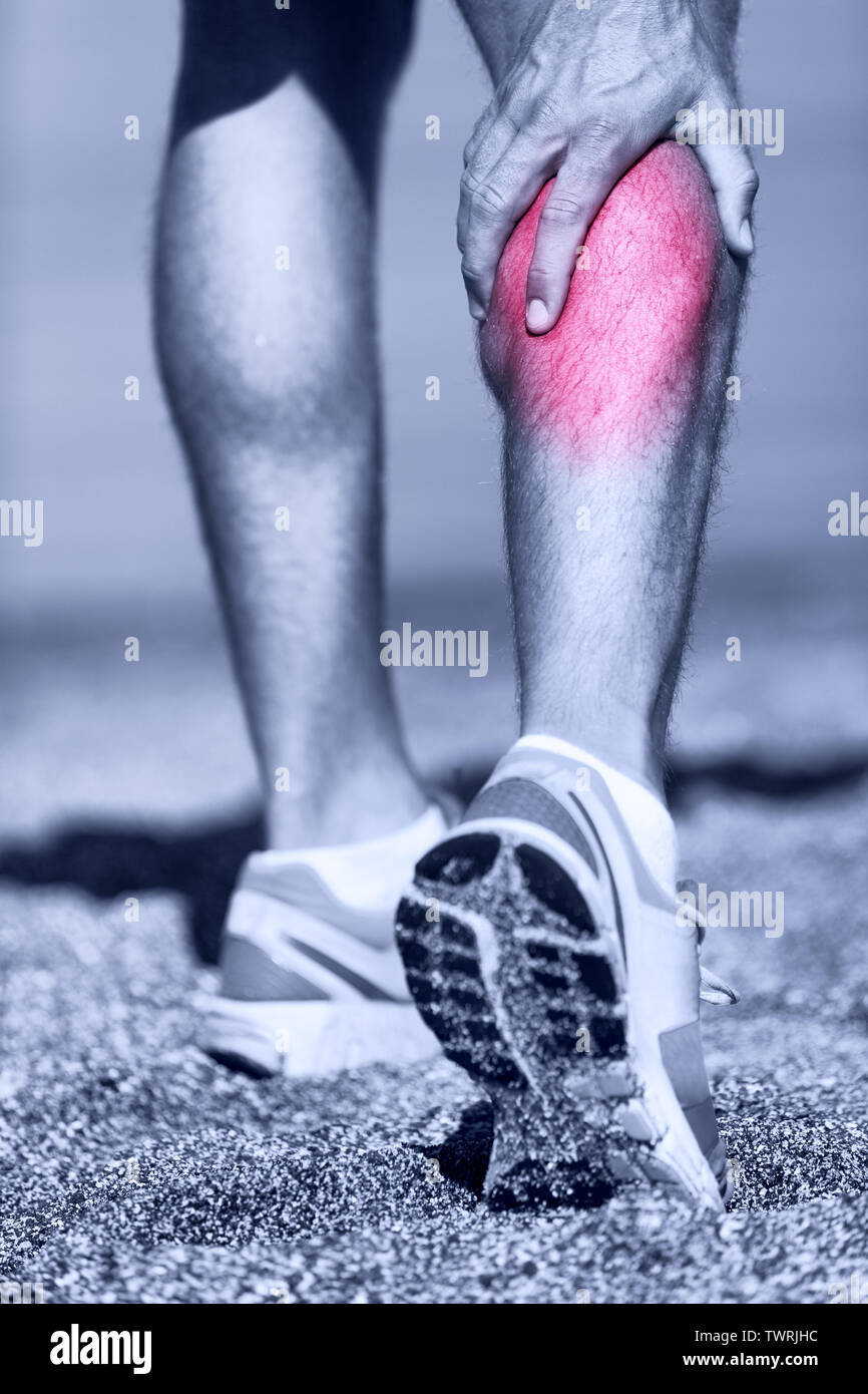 Muscle injury - Man running clutching calf muscle after spraining it while out jogging on the beach. Male athlete sport injury. Stock Photo