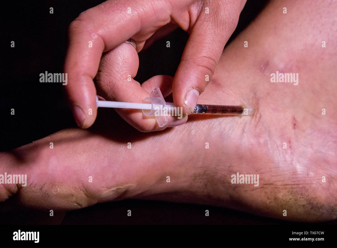 A person using a hypodermic needle to inject themselves in the foot with black tar heroin. Stock Photo