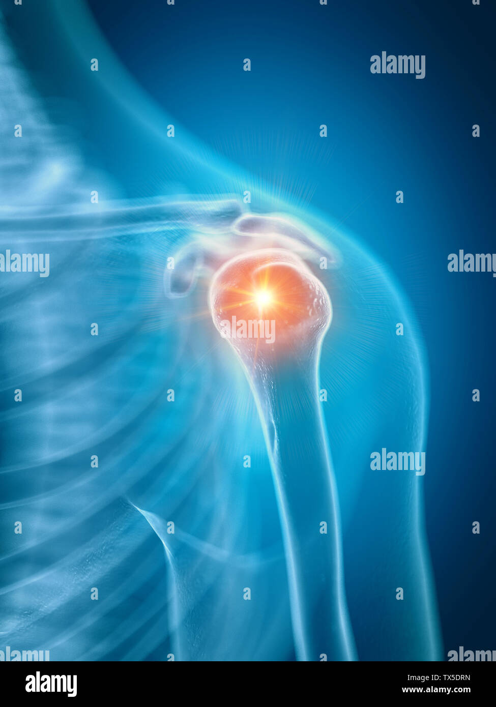 3d rendered medically accurate illustration of a painful shoulder Stock Photo