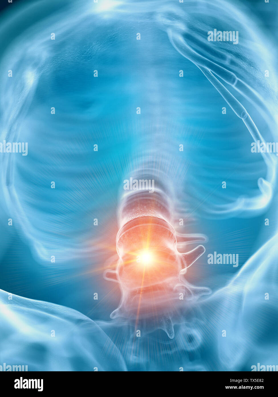 3d rendered medically accurate illustration of a painful lower spine ...
