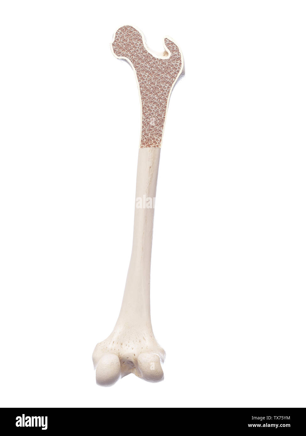 3d rendered, medically accurate illustration of osteoporosis Stock Photo