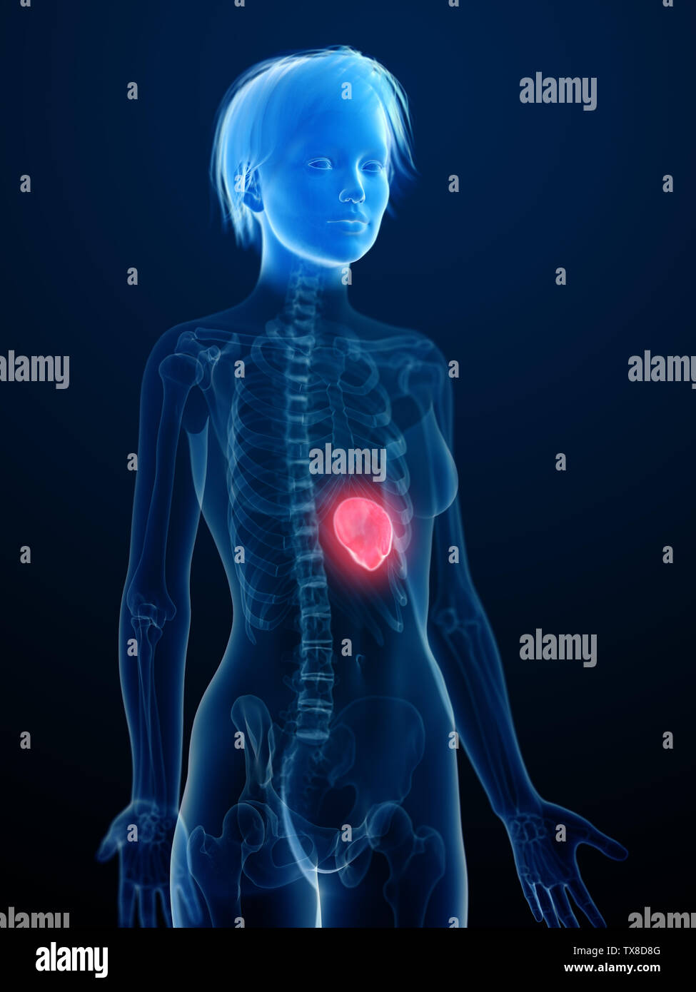 3d rendered medically accurate illustration of an inflamed spleen Stock