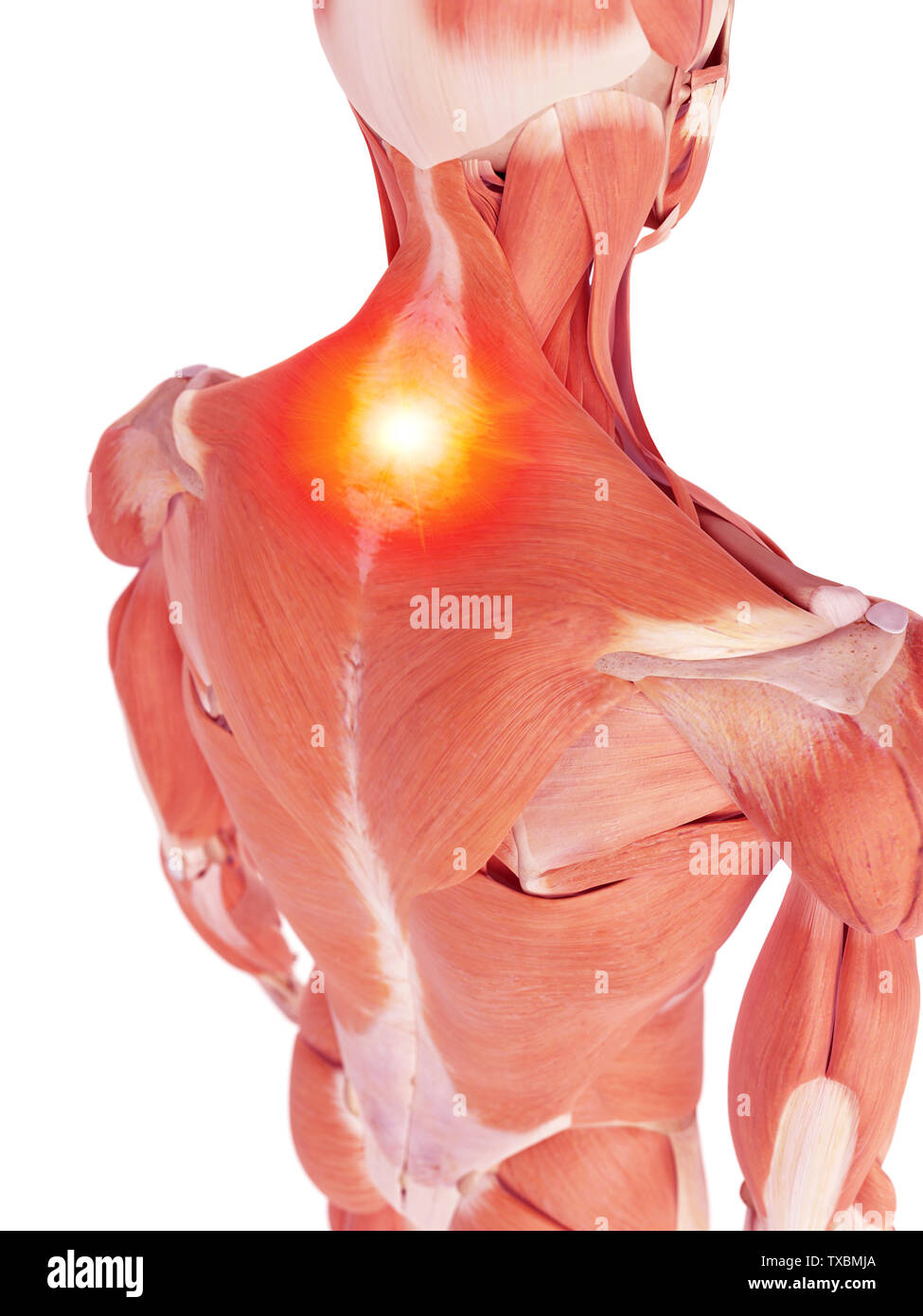 medical accurate illustration of the back muscles showing pain Stock Photo