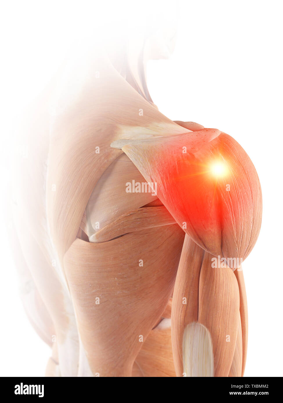 medical accurate illustration of the shoulder muscles showing pain Stock Photo