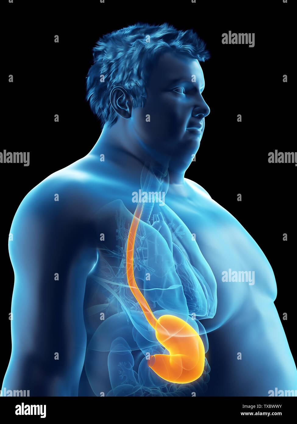 3d rendered medically accurate illustration of an obese mans stomach ...
