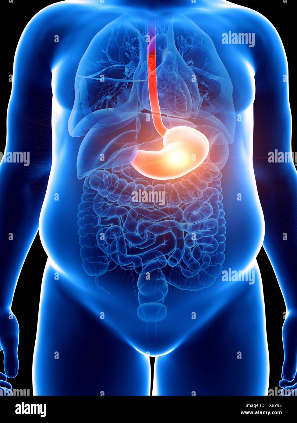 3d rendered medically accurate illustration of a obese man with a ...