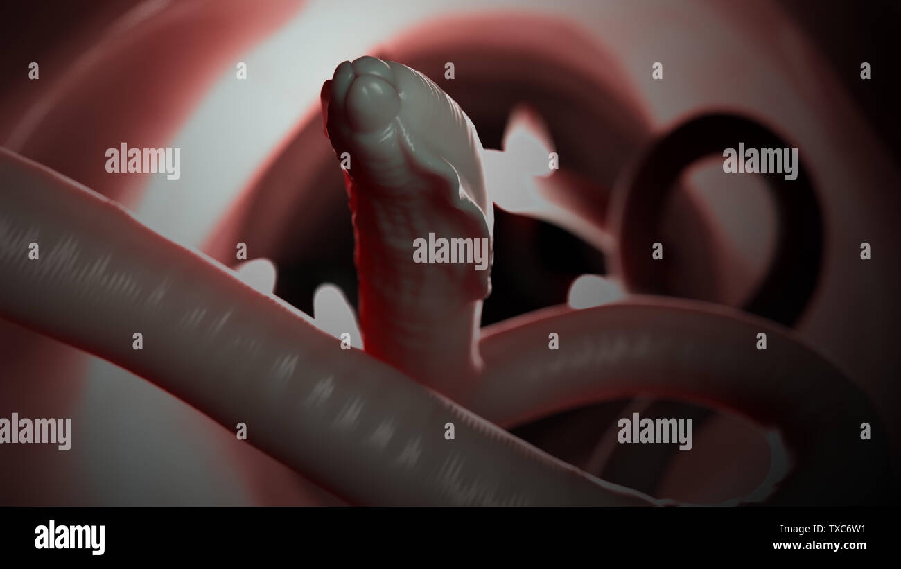 3d rendered medically accurate illustration of a roundworm Stock Photo