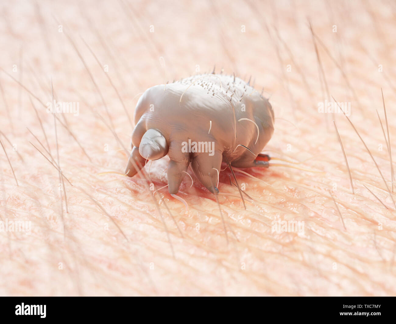 3d rendered medically accurate illustration of a scabies mite on human