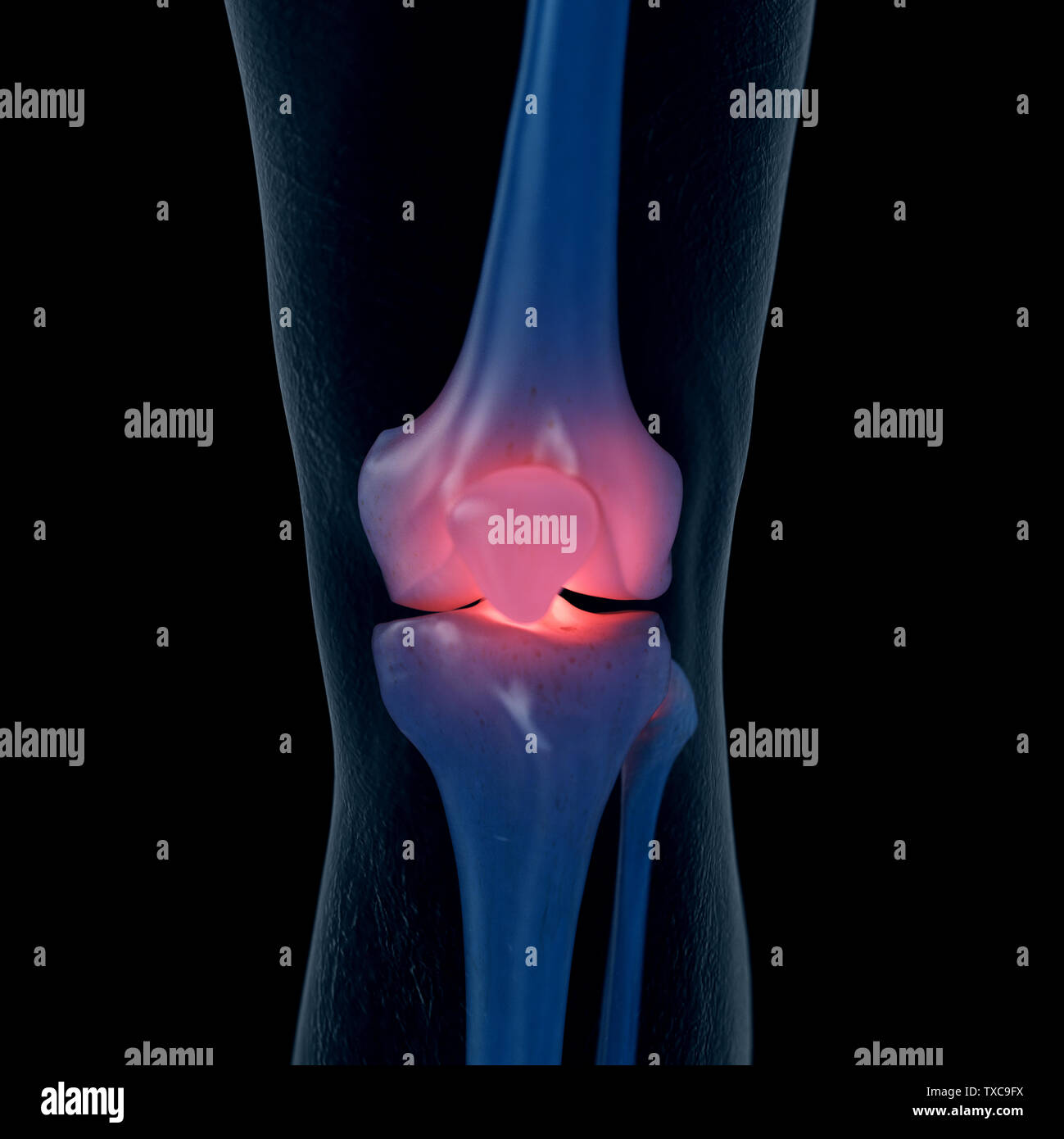 3d rendered medically accurate illustration of a painful knee Stock