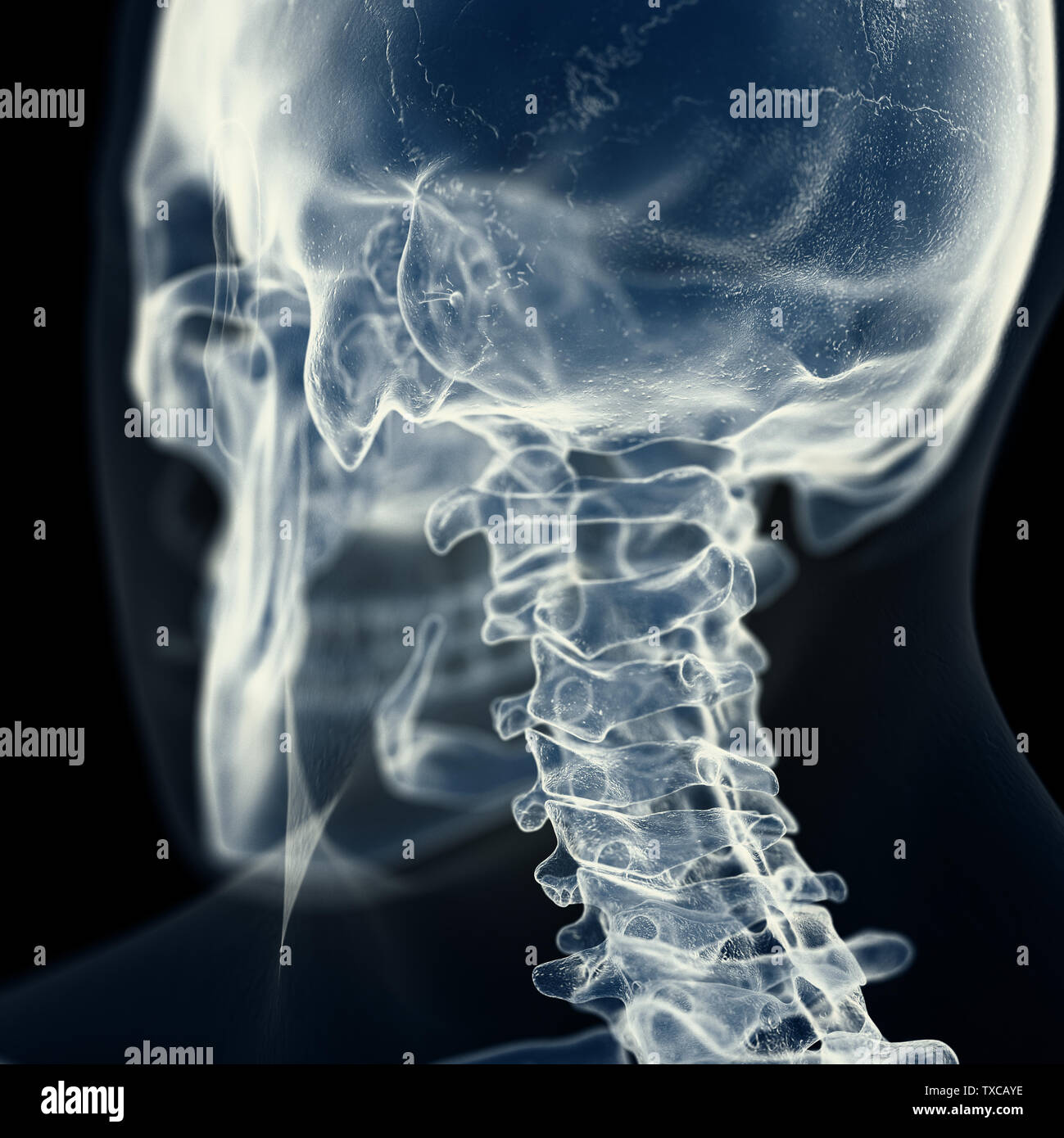 Xray cervical spine hi-res stock photography and images - Alamy