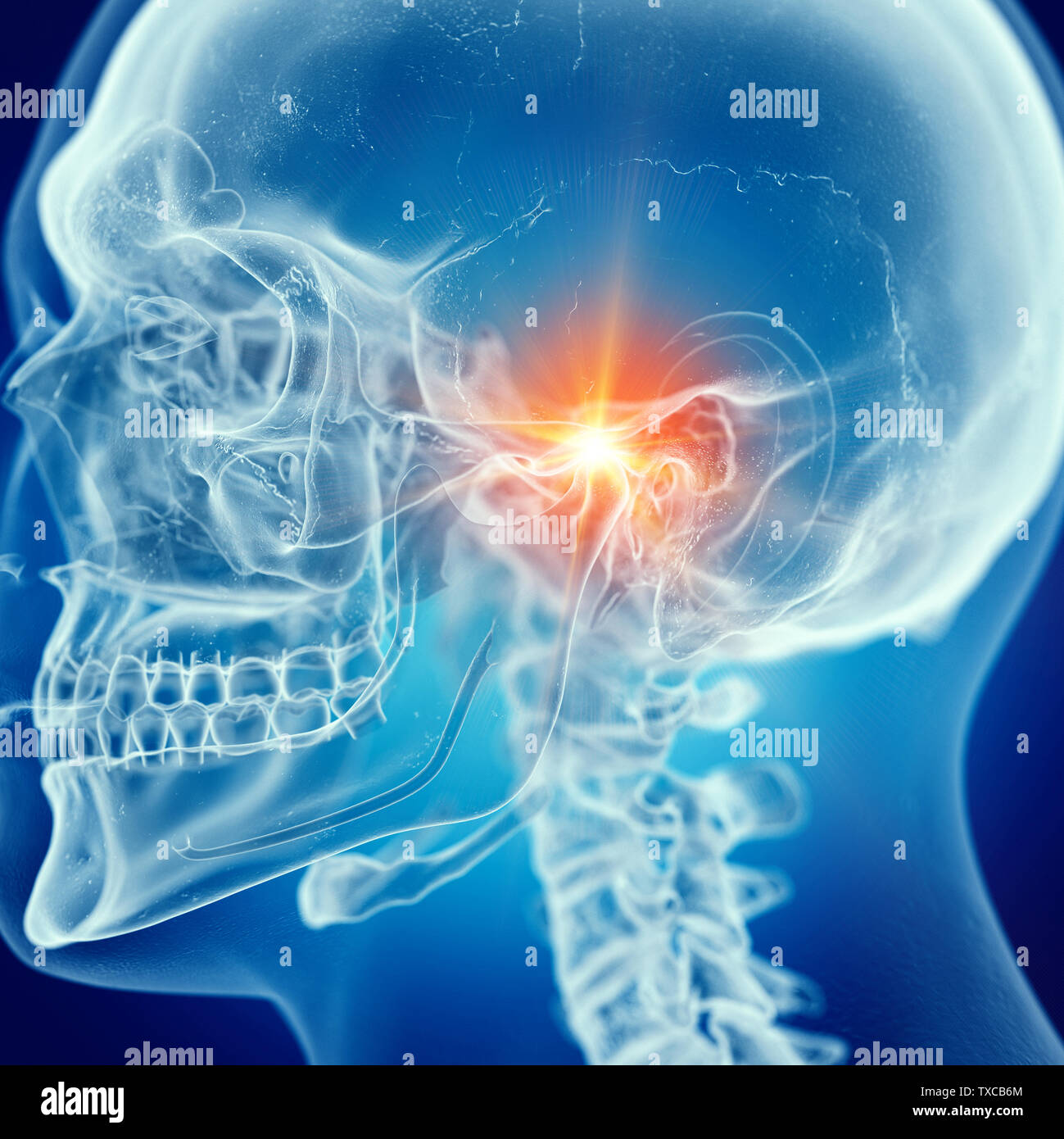 3d rendered medically accurate illustration of a painful temporomandibular joint Stock Photo