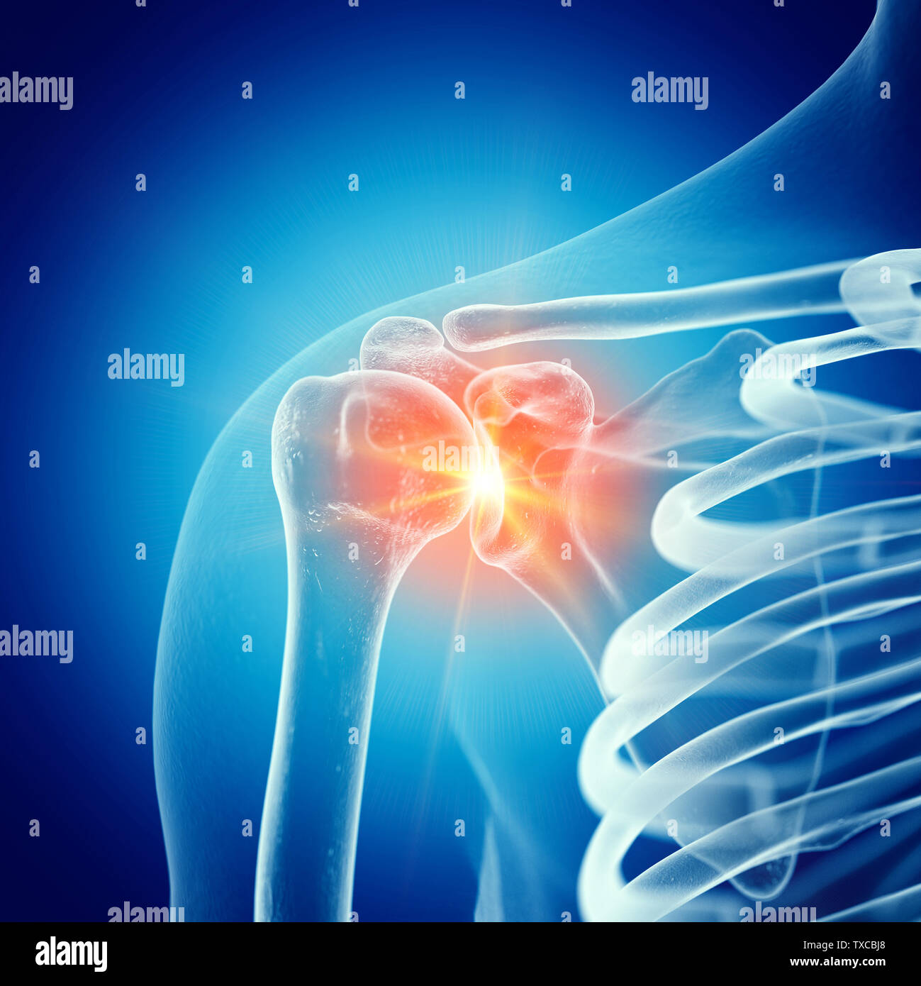 Painful Shoulder Joint High Resolution Stock Photography and Images - Alamy