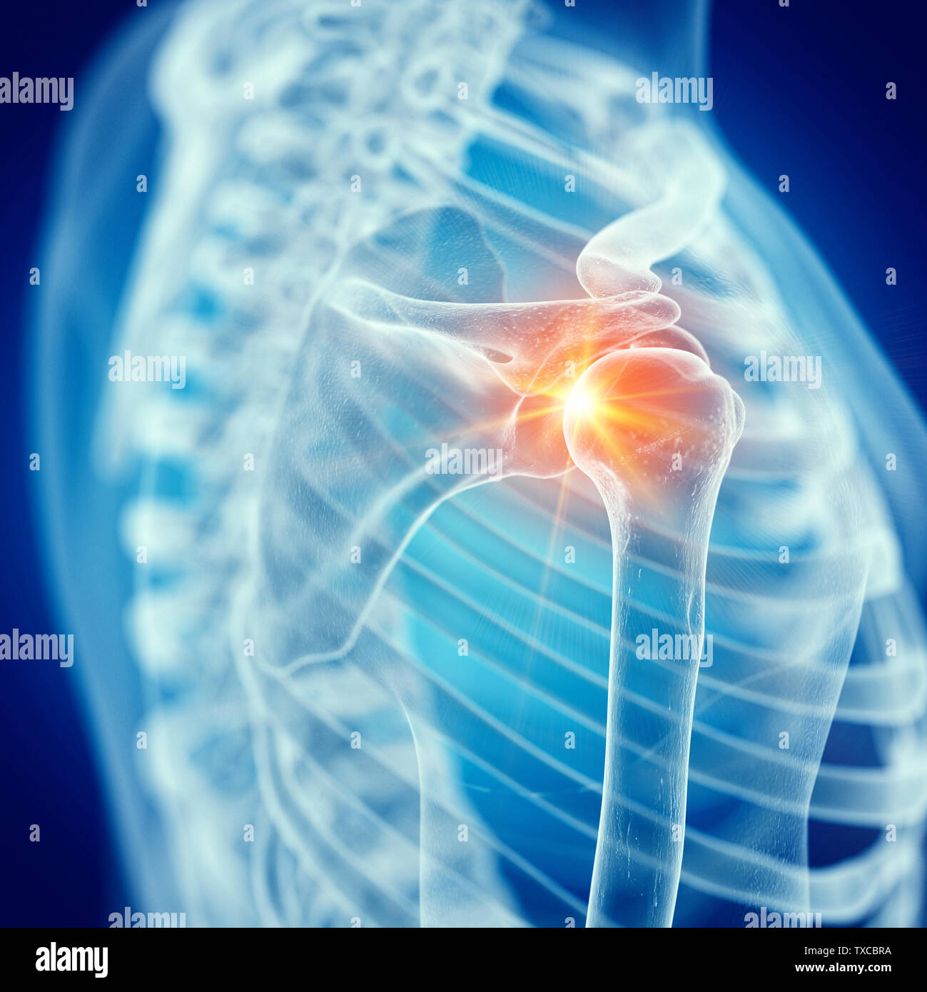 3d rendered medically accurate illustration of a painful shoulder joint Stock Photo