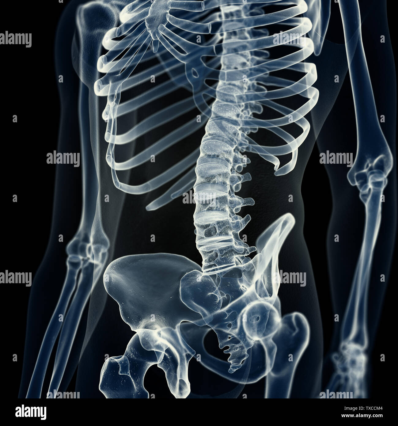 Xray of the lumbar spine hi-res stock photography and images - Alamy