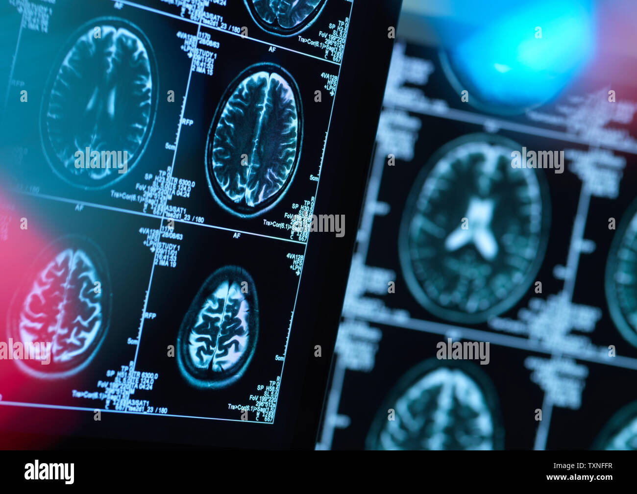 Brain scans of possible disease or damage in clinic Stock Photo