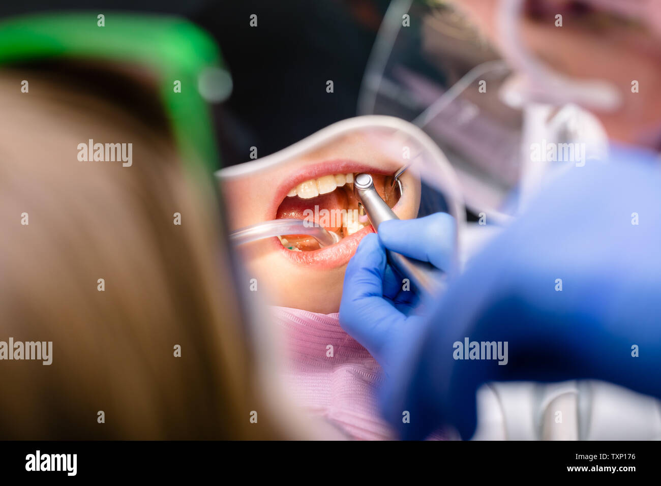 Child dental plaque teeth hires stock photography and images Alamy