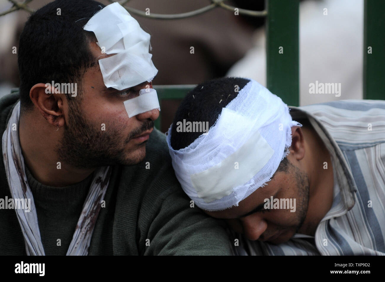 Injured Egyptian men are seen during clashes between anti-government demonstrators and their pro-government opponents in Cairo's Tahrir square on February 03, 2011. This is the 10th day of protests calling for the ouster of embattled President Hosni Mubarak.  UPI Stock Photo