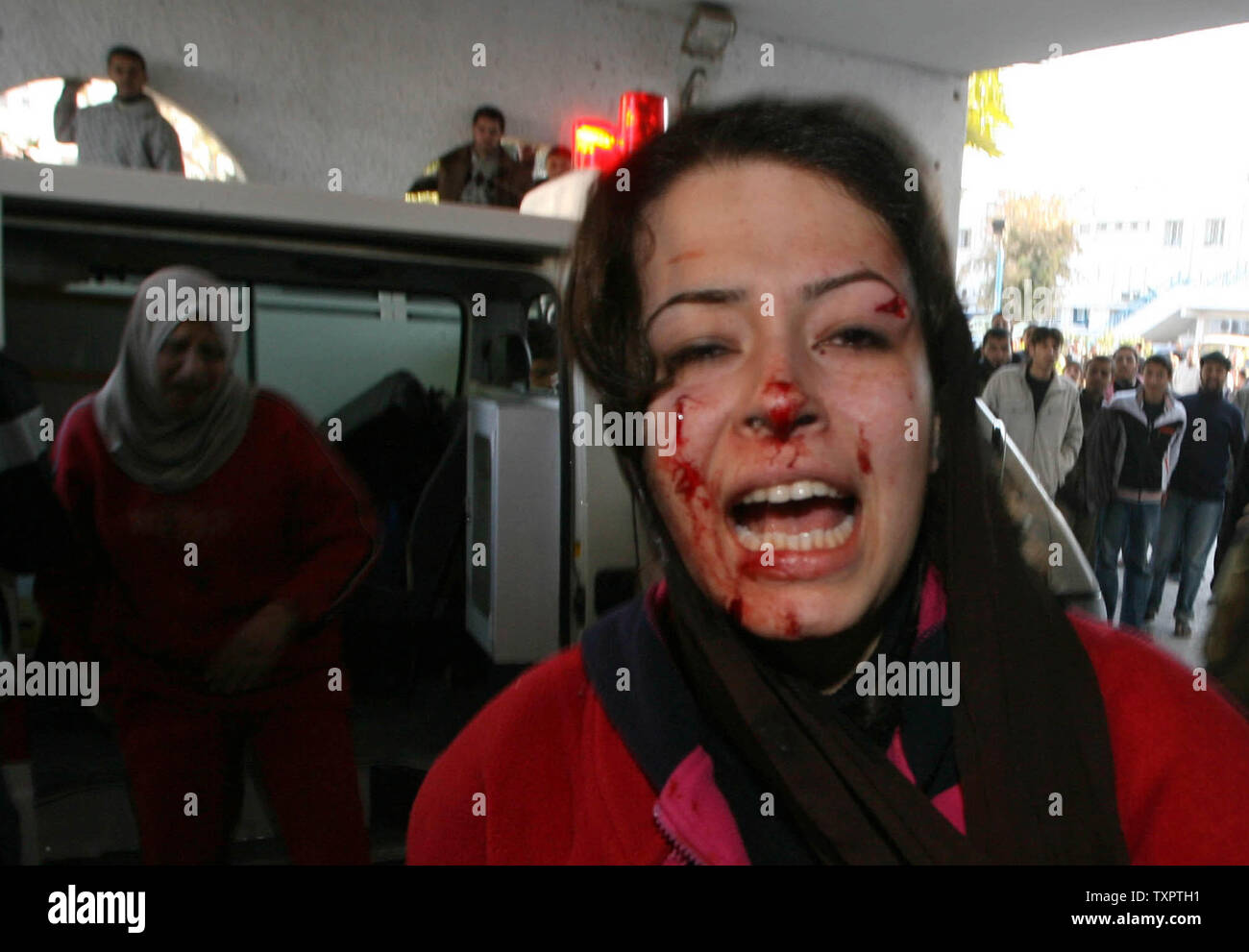 At Least Nobody Was Killed It Was No >> A Woman With Blood On Her Face Arrives At Al Shifa Hospital After An At Least Nobody Was Killed It Was No >> A Woman With Blood On Her Face Arrives At Al Shifa Hospital After An