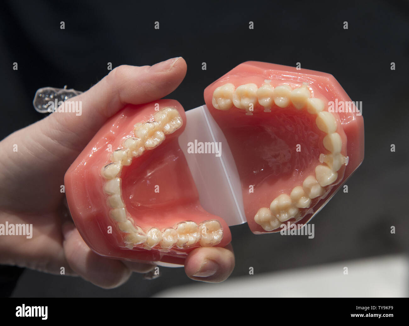 A prototype of a 3D printed model of teeth to produce invisalign