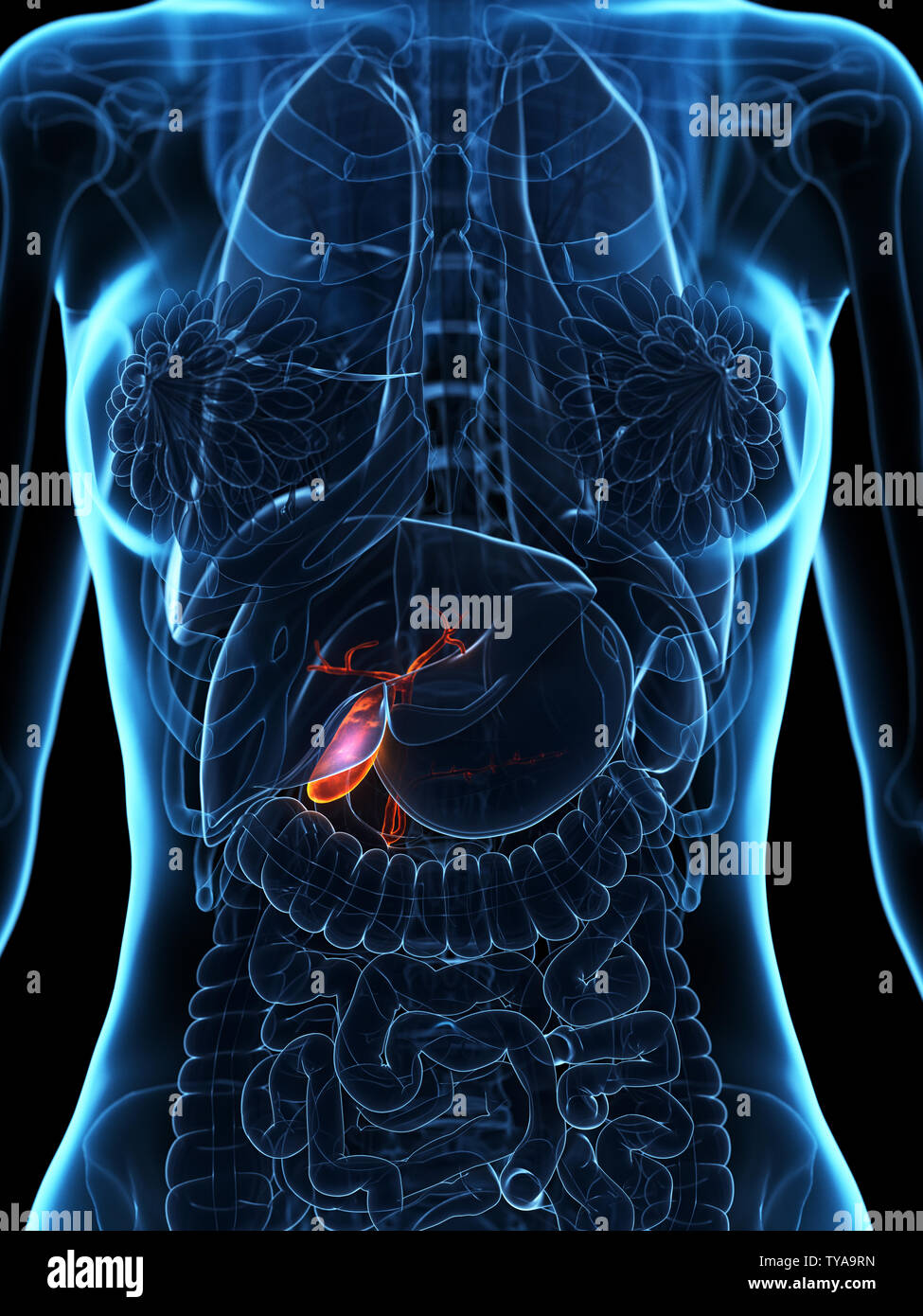 3d rendered medically accurate illustration of a diseased gallbladder Stock Photo