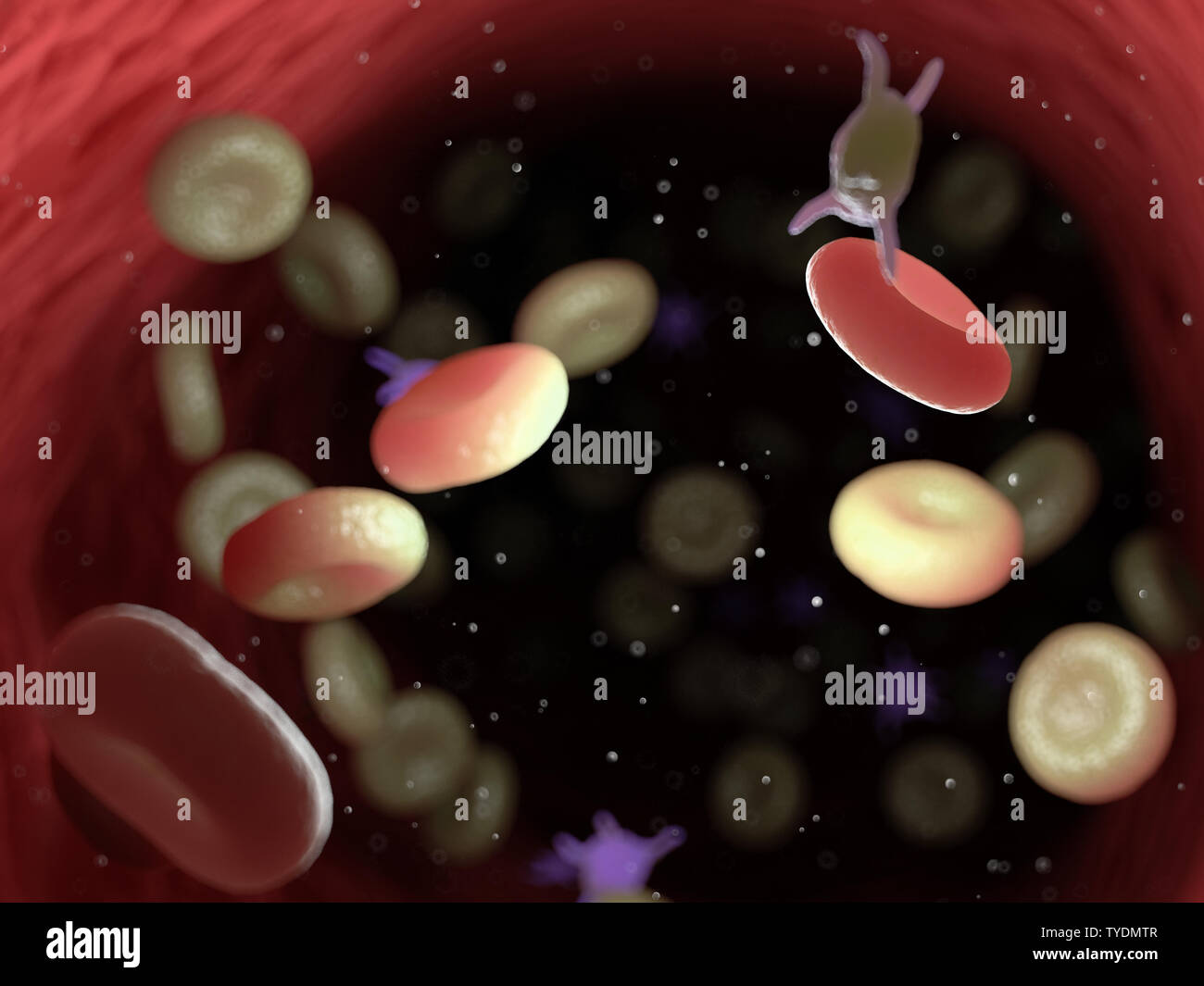 3d rendered medically accurate illustration of diseased blood cells ...