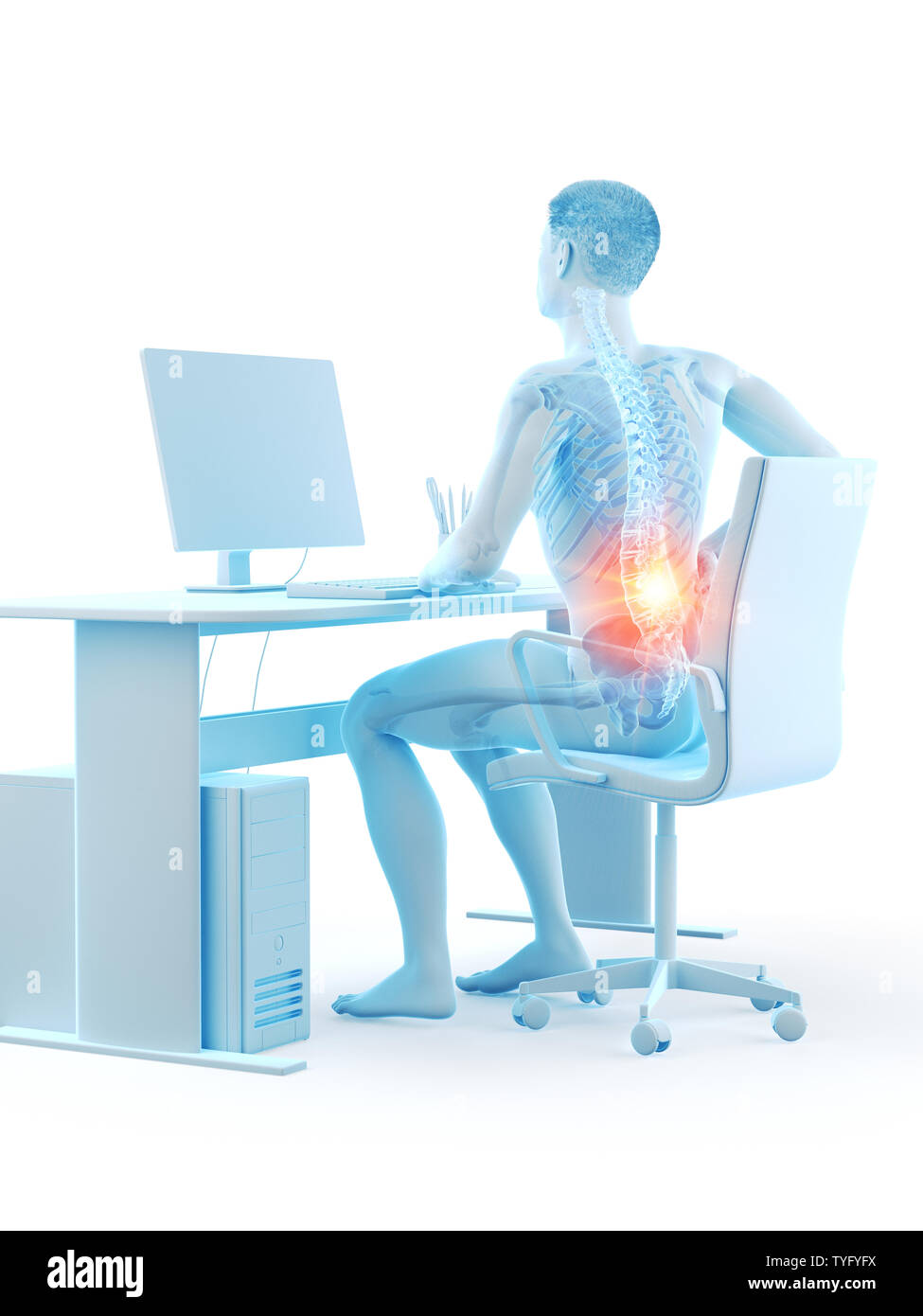 3d rendered medically accurate illustration of an office workers ...