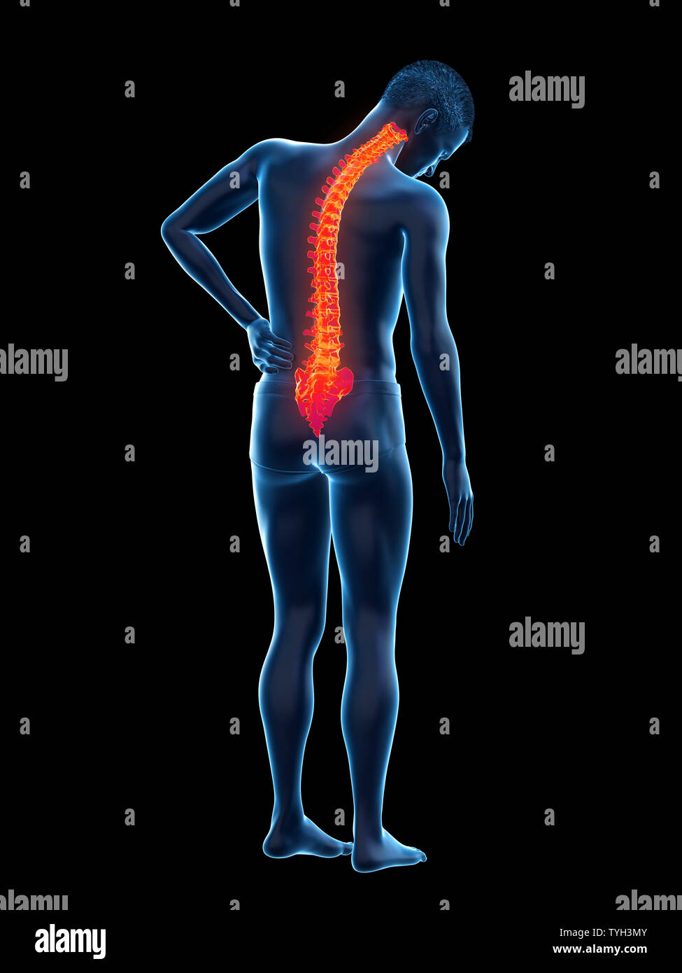 3d rendered medically accurate illustration of a man having backache ...