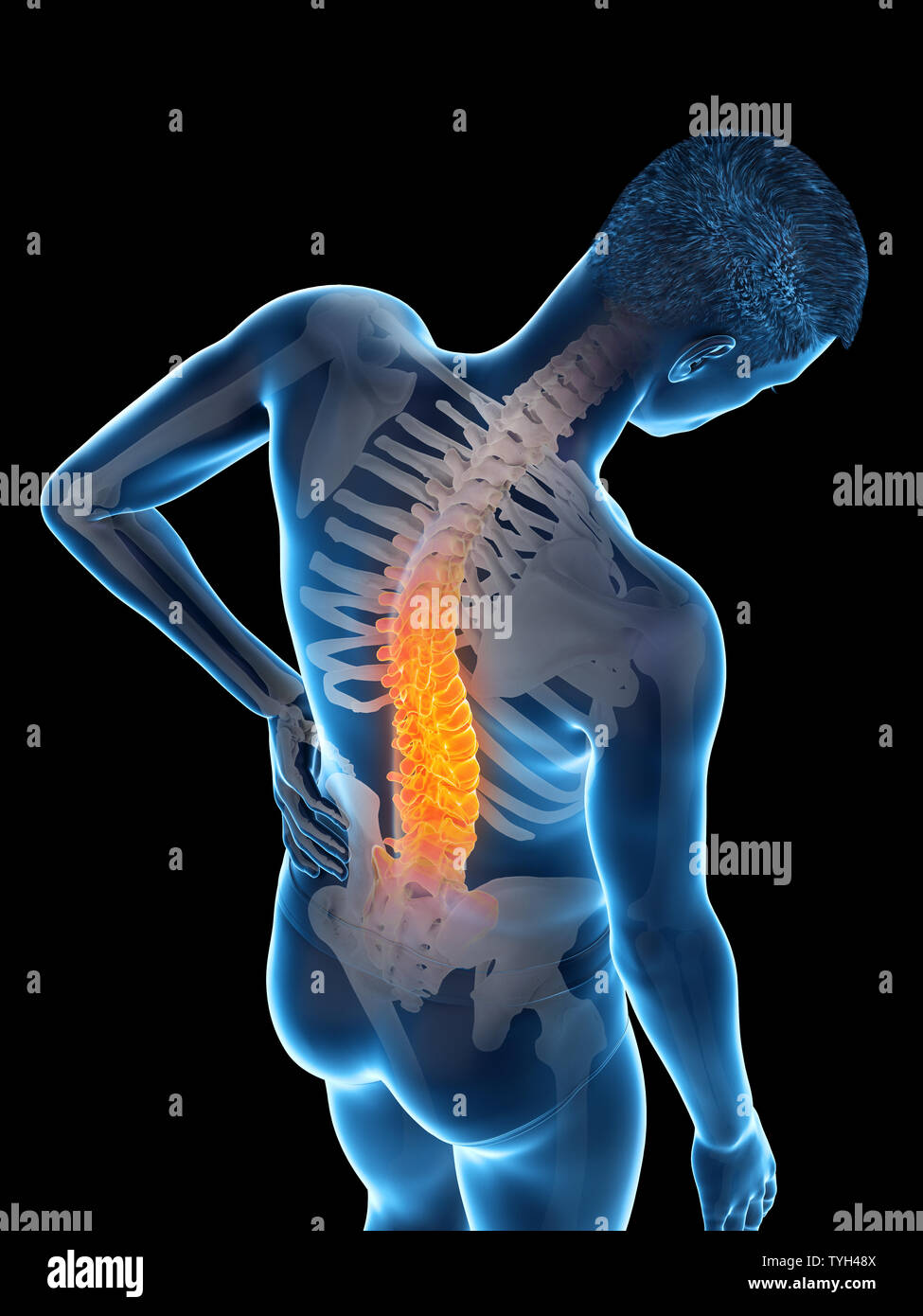 3d rendered medically accurate illustration of a man having backache ...