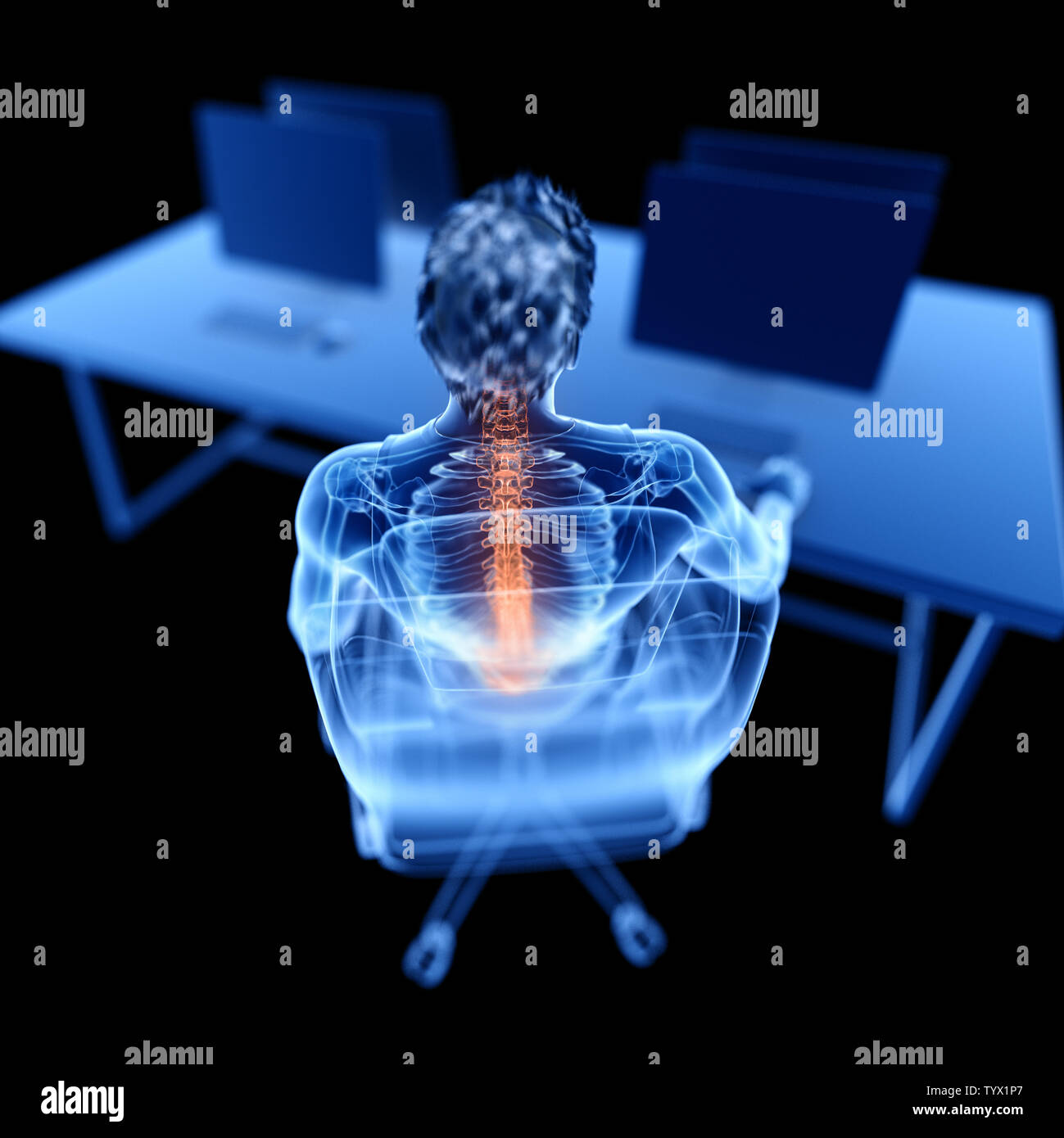 3d rendered medically accurate illustration of an office worker having ...