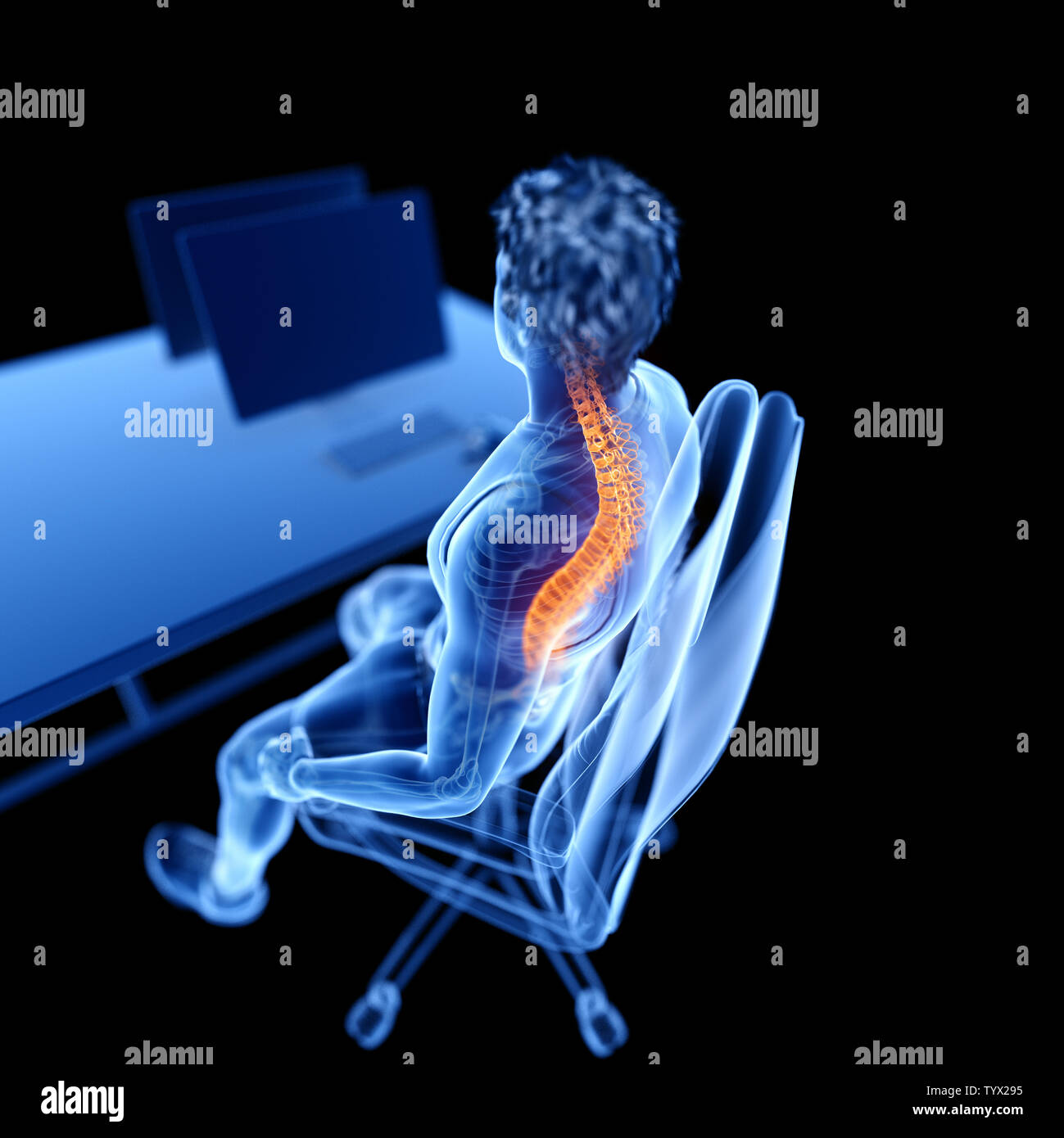3d rendered medically accurate illustration of an office worker having ...