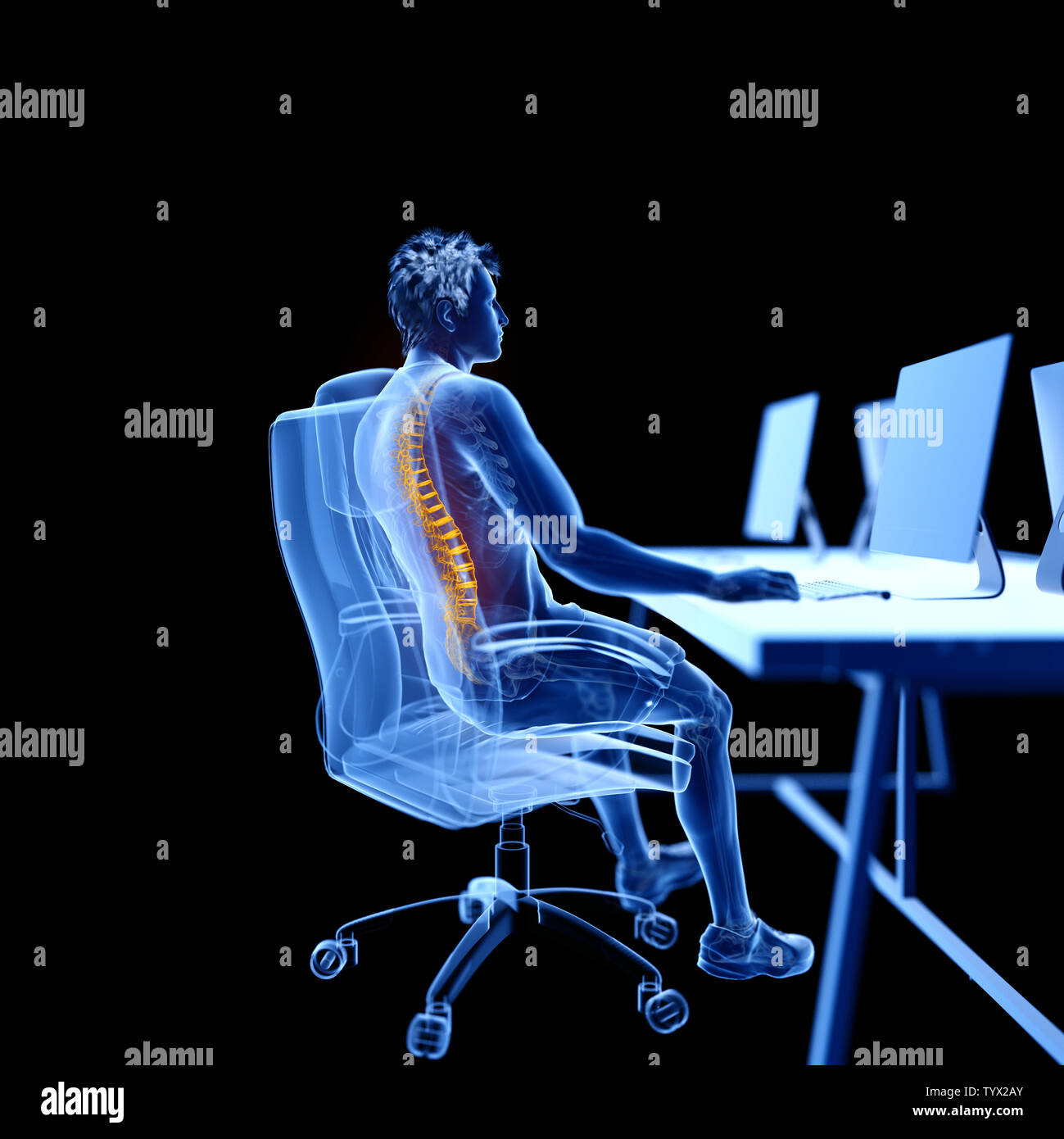 3d rendered medically accurate illustration of an office worker having ...