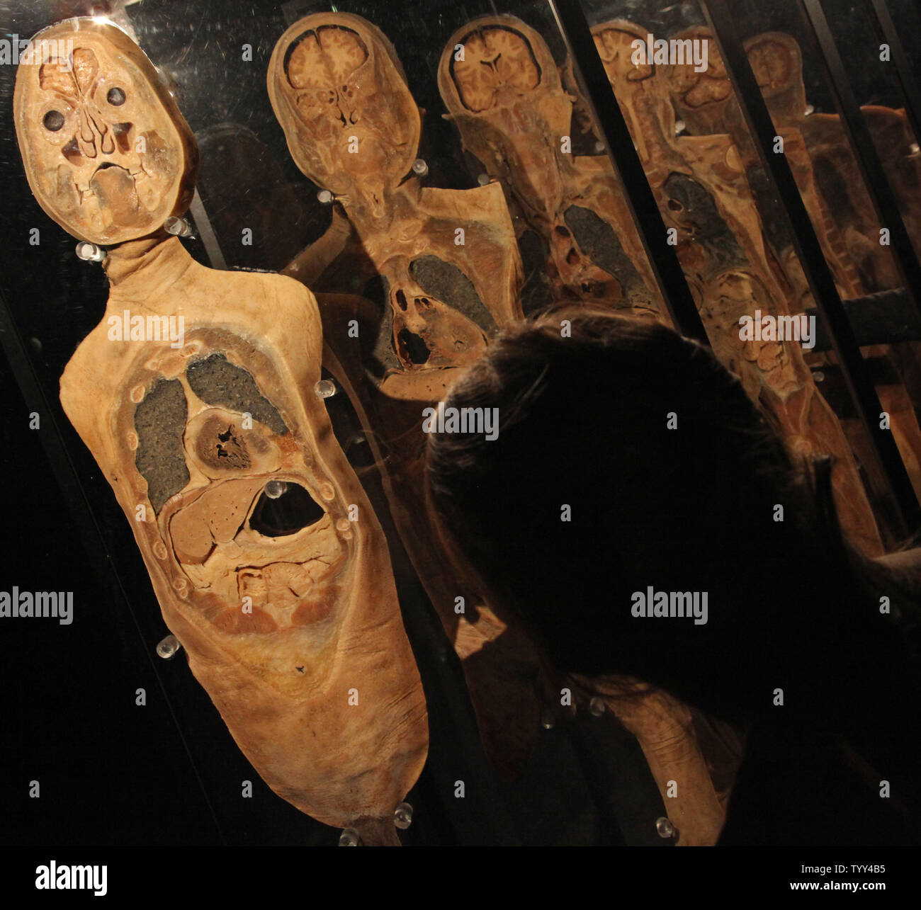 https://c8.alamy.com/comp/TYY4B5/a-museum-visitor-looks-at-cross-sections-of-a-preserved-chinese-cadaver-on-display-at-the-our-body-exhibition-taking-place-in-paris-on-april-15-2009-the-exhibition-has-sparked-controversy-over-ethical-implications-of-the-displays-and-has-led-to-two-human-rights-groups-seeking-an-injunction-to-shut-it-down-upi-photo-david-silpa-TYY4B5.jpg