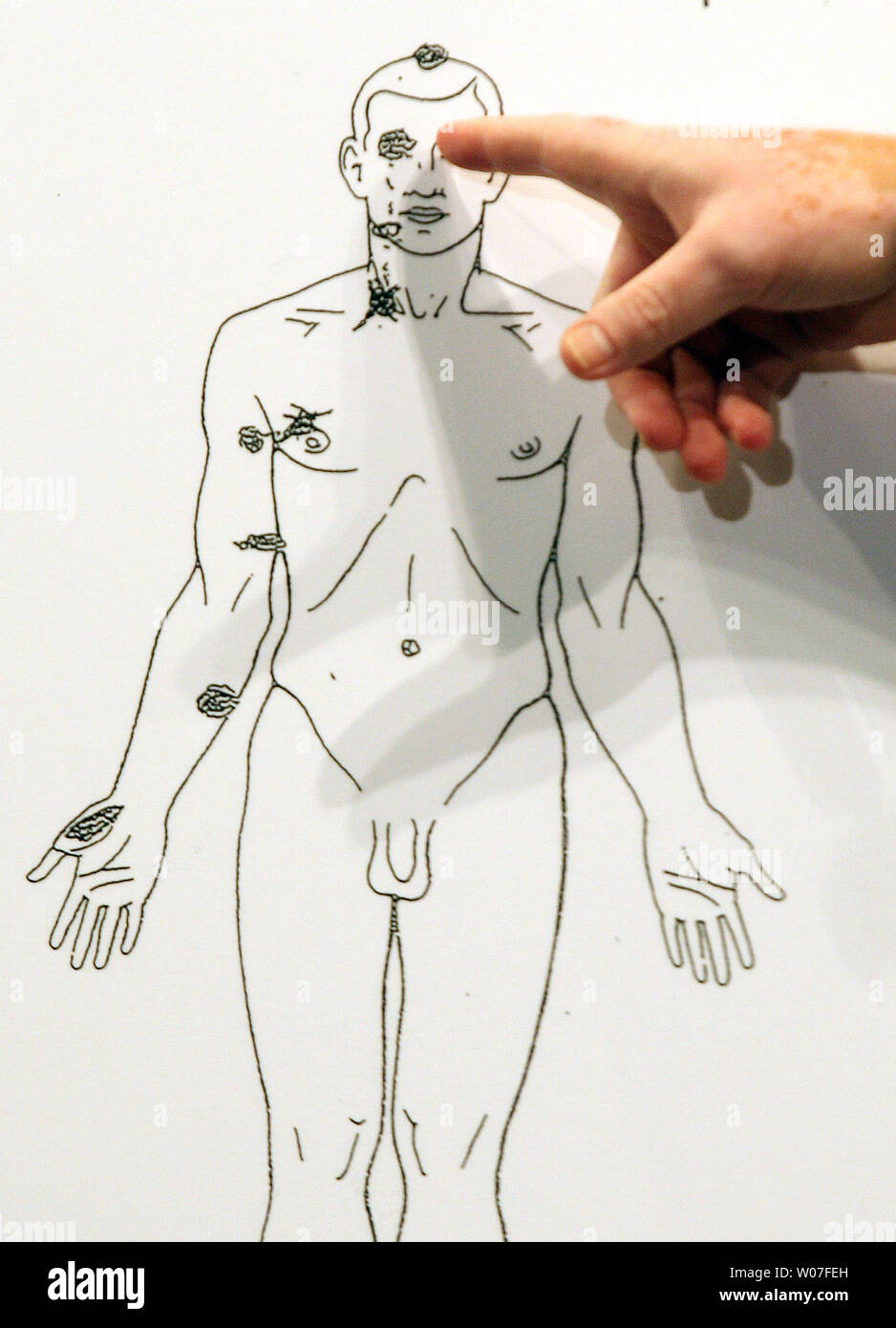 Prof. Shawn Parcells points to one of the shots that hit teen Michael Brown during a preliminary autopsy report in Ferguson, Missouri on August 18, 2014. Parcells and Dr. Michael M. Baden, the former chief medical examiner for the City of New York, performed an autopsy at the request of the family of Brown. Baden reports that Brown was shot six times and the wound to the head was most likely the shot that killed Brown. Brown was shot by a St. Louis County officer after a struggle for the officers weapon and fight on August 9, 2014. UPI/Bill Greenblatt Stock Photo