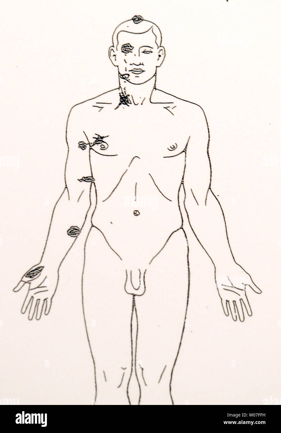 A preliminary autopsy report on Michael Brown was disclosed at a press conference in Ferguson, Missouri on August 18, 2014. Dr. Michael M. Baden, the former chief medical examiner for the City of New York, performed an autopsy at the request of the family of Brown. Baden reports that Brown was shot six times and the wound to the head was most likely the shot that killed Brown. Brown was shot by a St. Louis County officer after a struggle for the officers weapon and fight on August 9, 2014. UPI/Bill Greenblatt Stock Photo