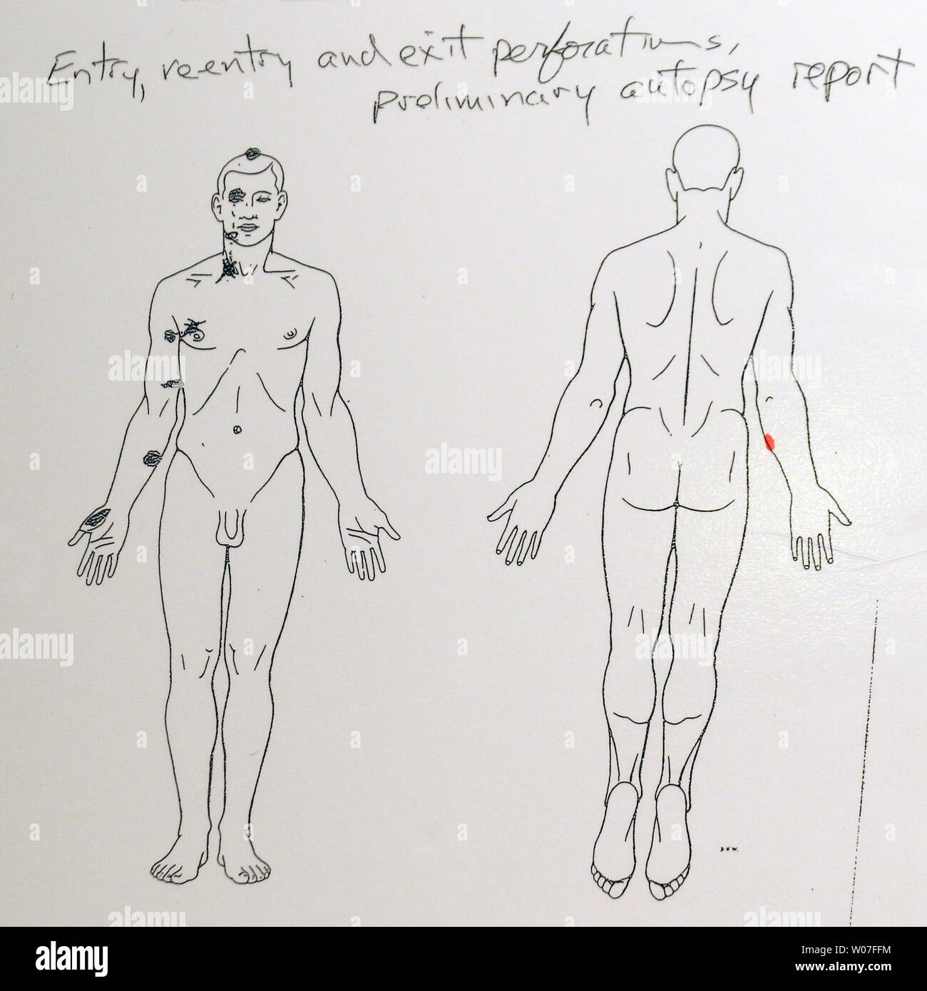 A preliminary autopsy report on Michael Brown was disclosed at a press conference in Ferguson, Missouri on August 18, 2014. Dr. Michael M. Baden, the former chief medical examiner for the City of New York, performed an autopsy at the request of the family of Brown. Baden reports that Brown was shot six times and the wound to the head was most likely the shot that killed Brown. Brown was shot by a St. Louis County officer after a struggle for the officers weapon and fight on August 9, 2014. UPI/Bill Greenblatt Stock Photo