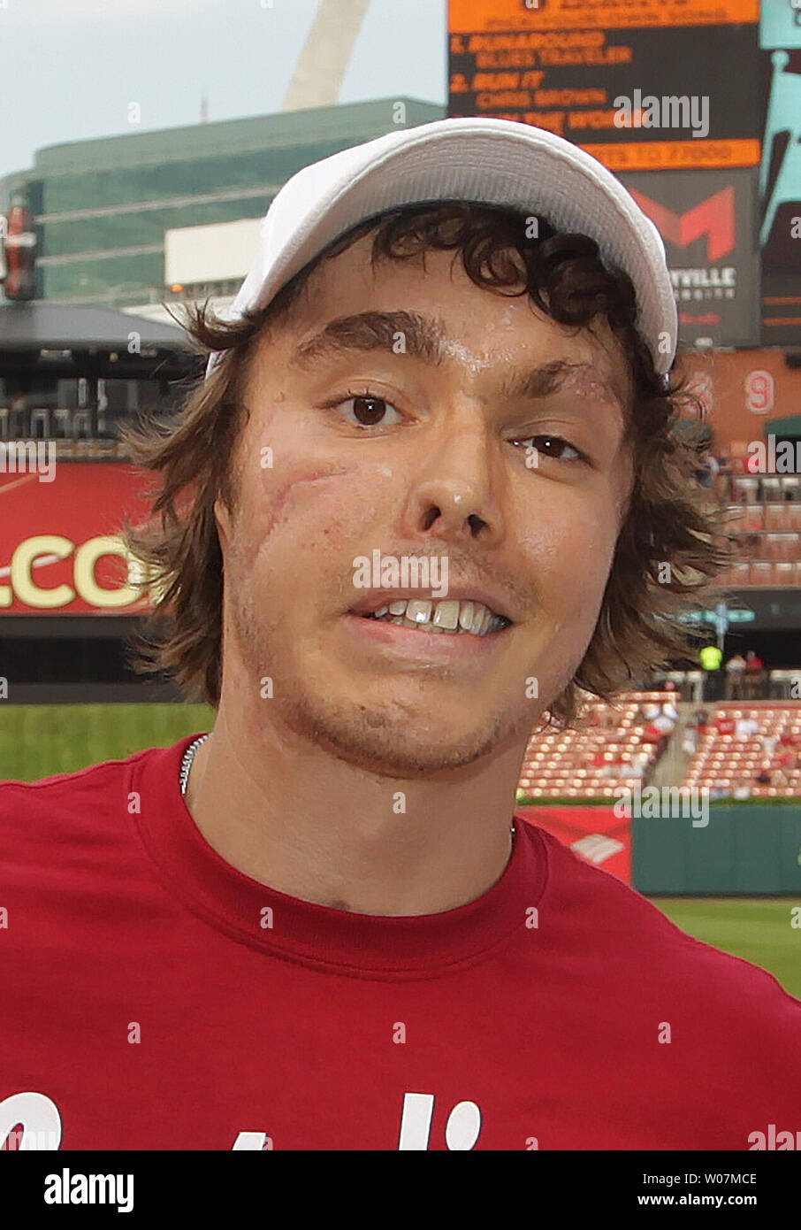 Andrew Oberle A Native St Louisan Who Gained National Attention When He Was Attacked By Chimpanzees While Working In South Africa In 2012 Is Introduced Before Throwing A Ceremonial First Pitch At
