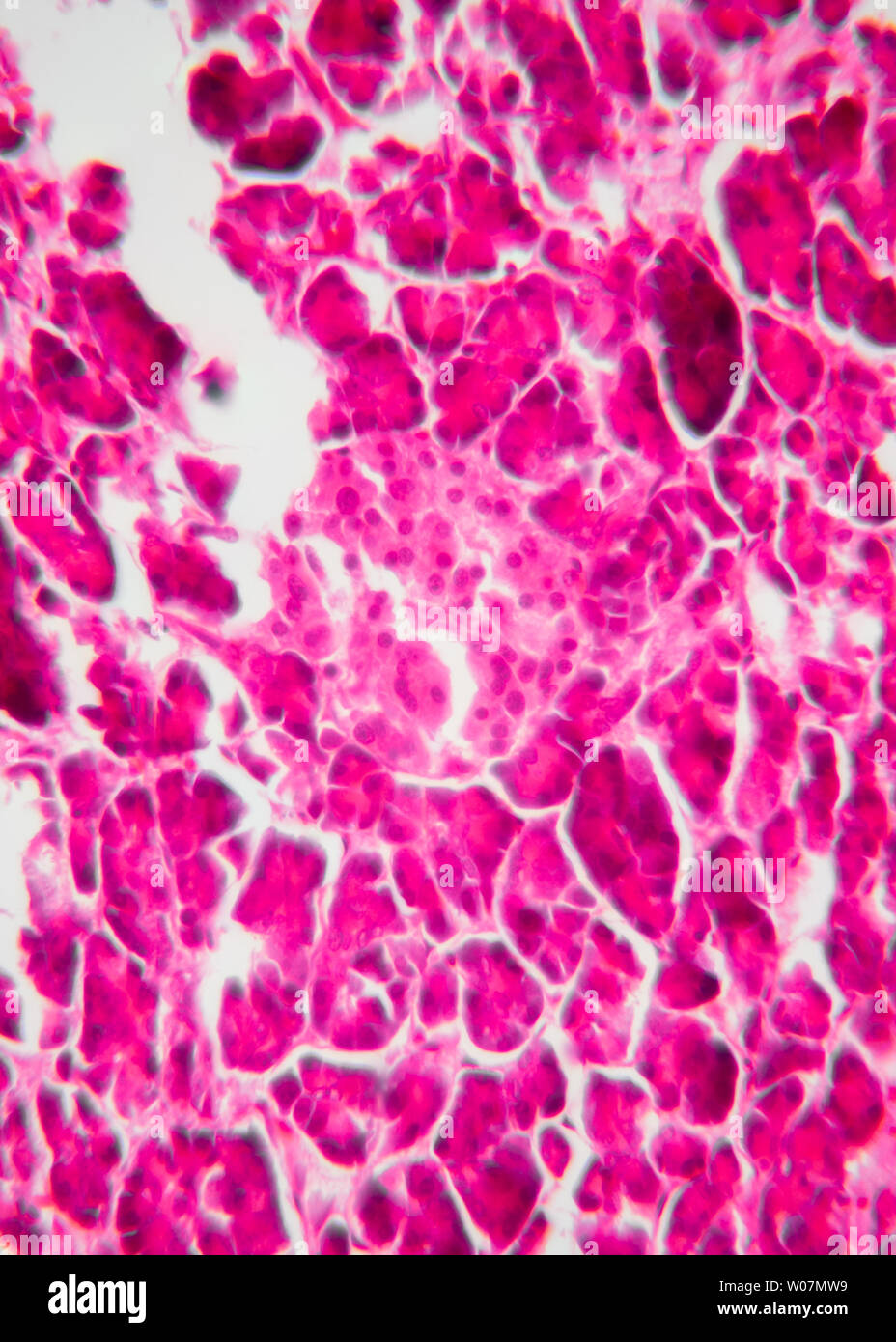 The Endocrine Part Of The Pancreas Islet And The Exocrine Part Magnified By An Optical Microscope 400 Times Shows The Islet Stock Photo Alamy The Endocrine Part Of The Pancreas Islet And The Exocrine Part Magnified By An Optical Microscope 400 Times Shows The Islet Stock Photo Alamy