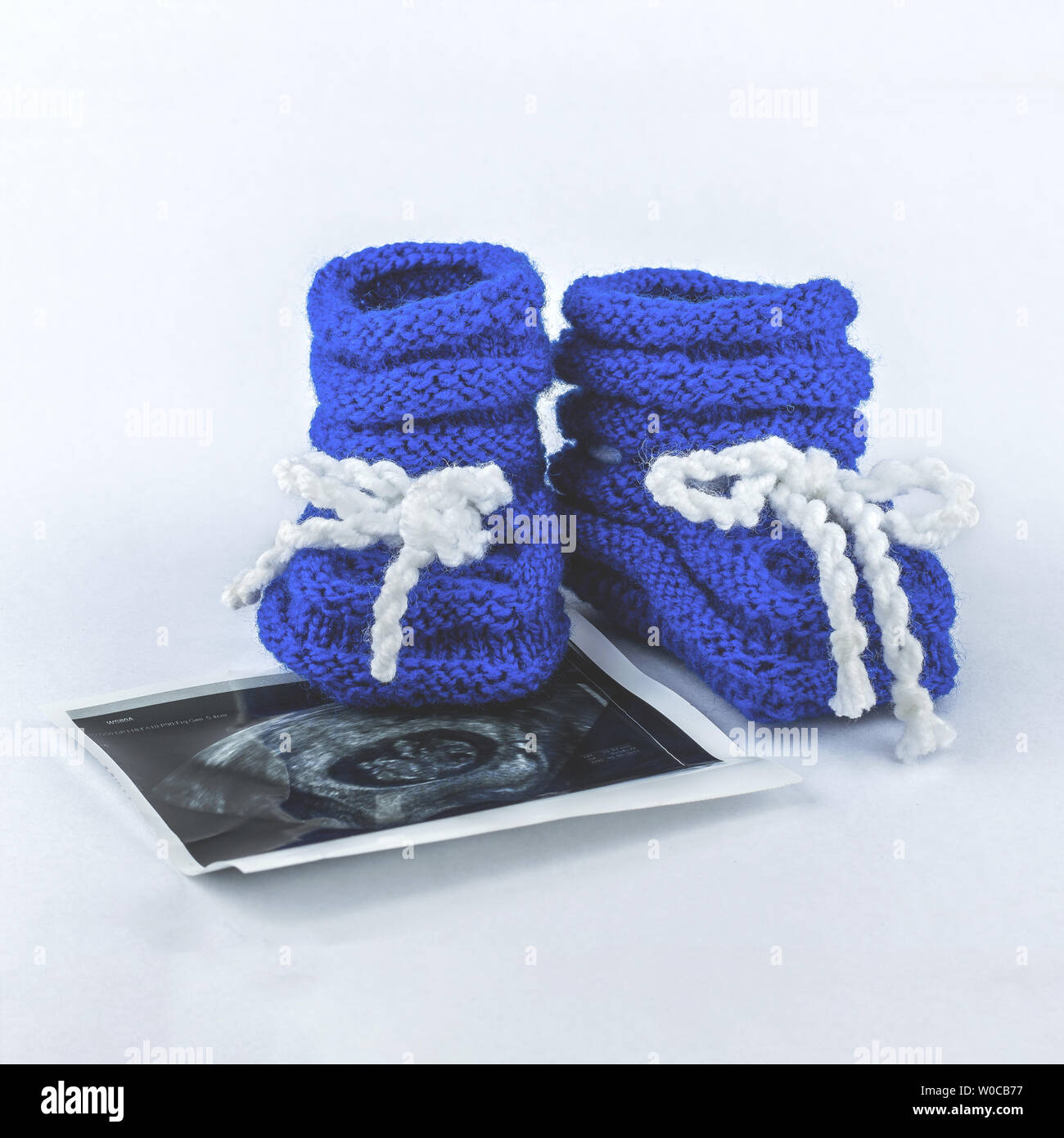 It is a boy. Pregnancy. Waiting for a baby. Blue slippers with a photo of ultrasound on a white background. Stock Photo