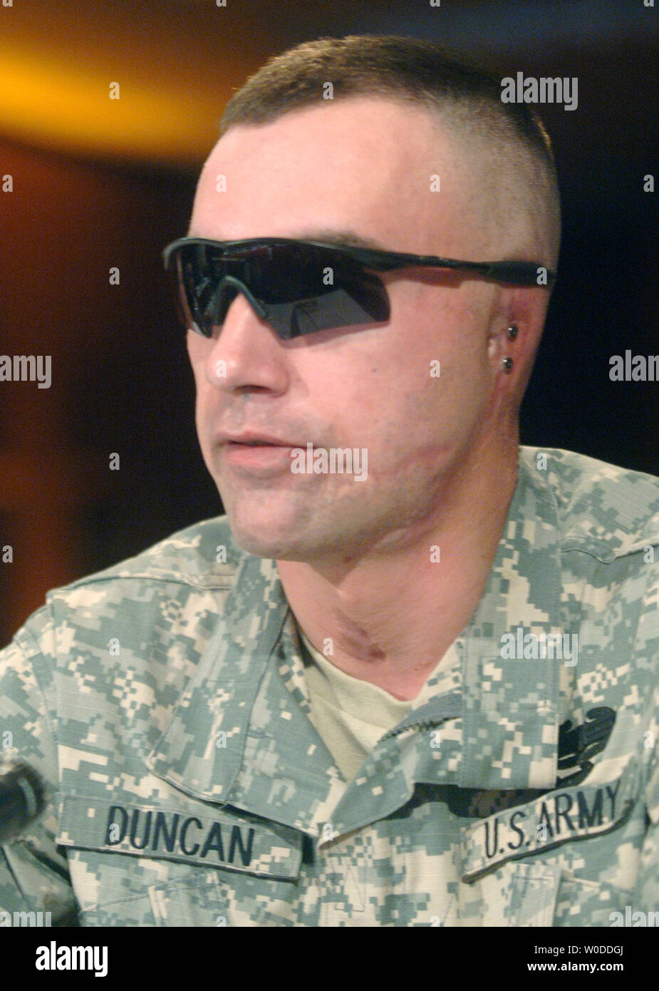 Army Specialist Jeremy Duncan, who lost his ear in combat operations in Iraq and received treatment at the Walter Reed Army Medical Center, testifies to a House Oversight and Government Reform Committee Hearing on the care and conditions of wounded soldiers at Walter Reed, in Washington at the Walter Reed Army Medical Center on March 5, 2007. (UPI Photo/Kevin Dietsch) Stock Photo