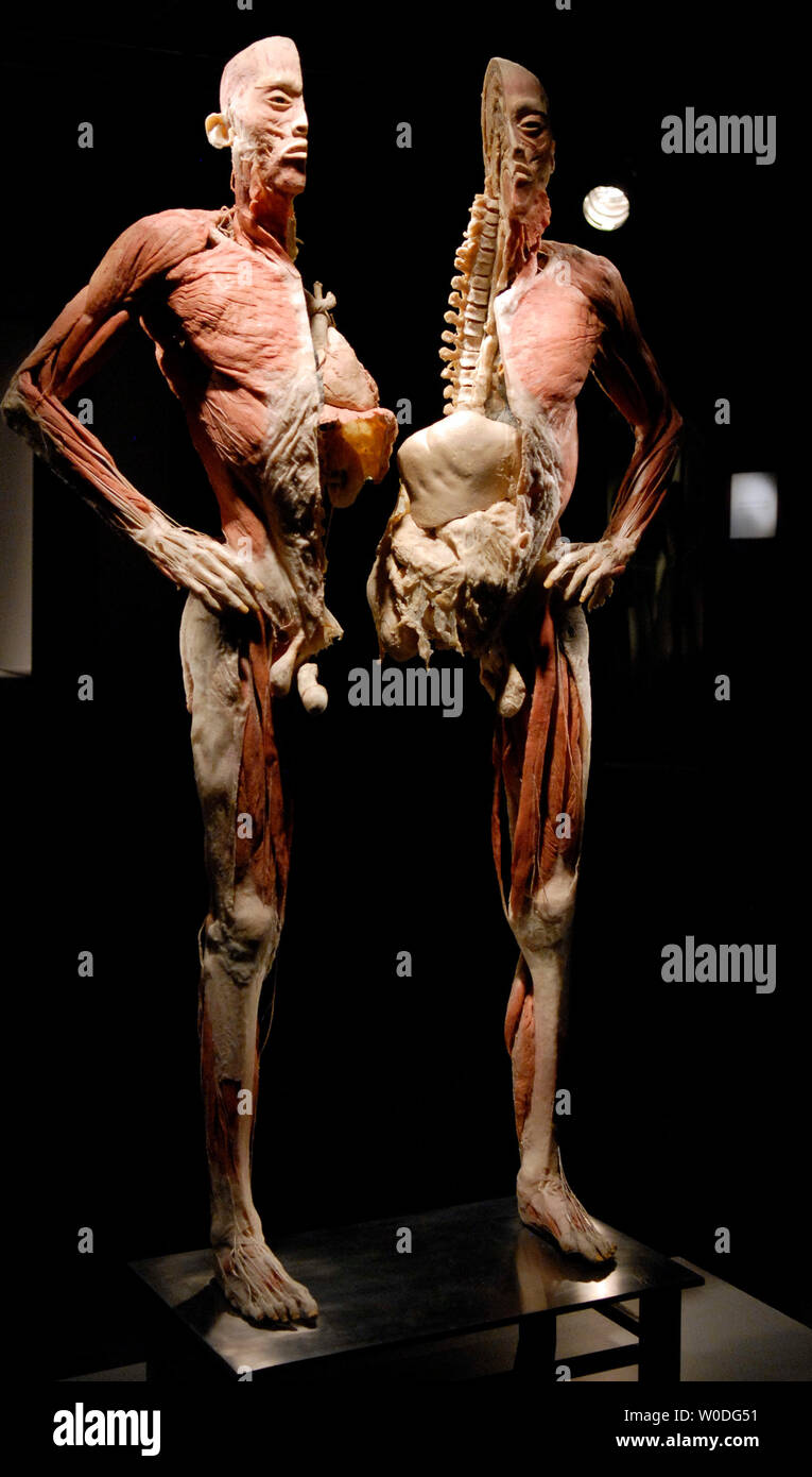 A dissected human specimen is on display at 'Bodies...The Exhibition', at The Dome in Rosslyn, Virginia on April 12, 2007. Bodies showcases real, whole and partial body specimens that have been donated and then specially preserved.  (UPI Photo/Kevin Dietsch) Stock Photo