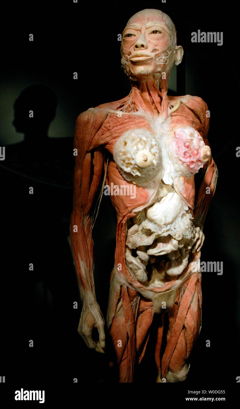 A preserved human specimen is on display at 'Bodies...The Exhibition', at The Dome in Rosslyn, Virginia on April 12, 2007. Bodies showcases real, whole and partial body specimens that have been donated and then specially preserved.  (UPI Photo/Kevin Dietsch) Stock Photo
