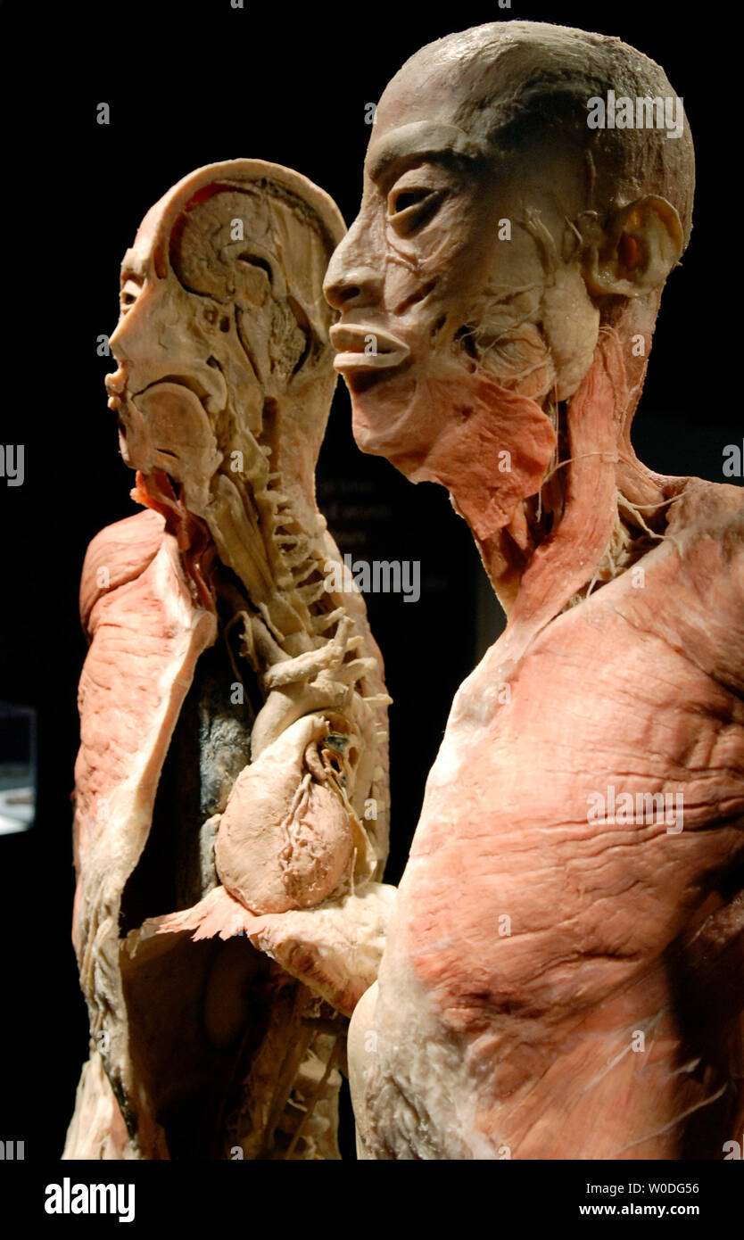 A dissected human specimen is on display at 'Bodies...The Exhibition', at The Dome in Rosslyn, Virginia on April 12, 2007. Bodies showcases real, whole and partial body specimens that have been donated and then specially preserved.  (UPI Photo/Kevin Dietsch) Stock Photo