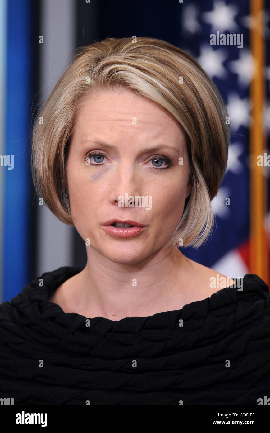 White House Press Secretary Dana Perino delivers her daily press briefing  at the White House in Washington on December 16, 2008. Perino, who has a  bruise under her right eye, was hit