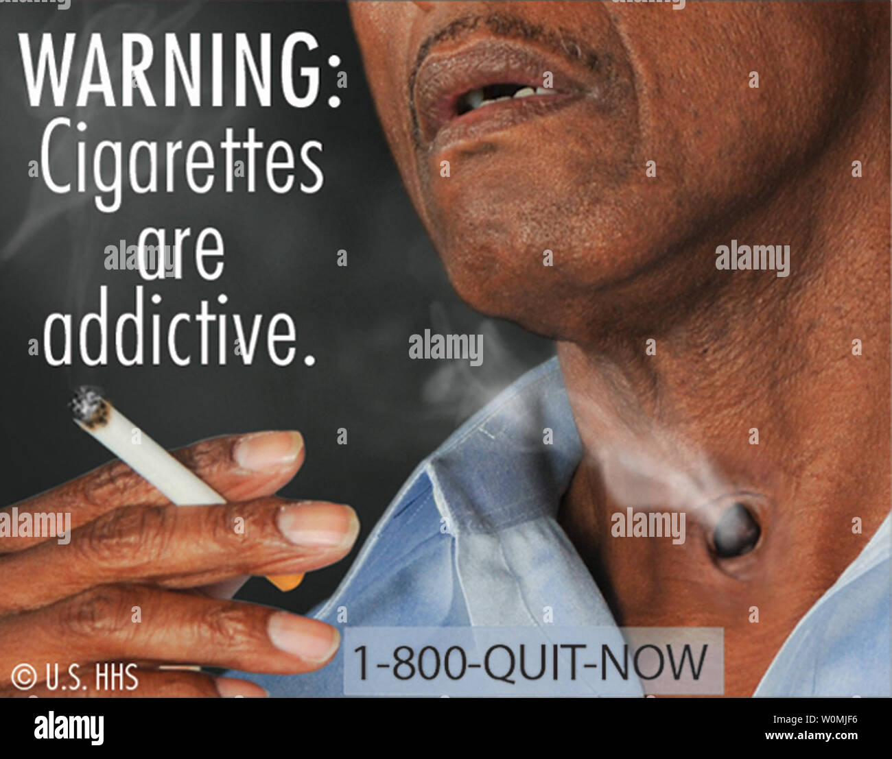 This Fda Image Released On June 21 2011 Shows One Of The New Proposed Cigarette Warning Labels