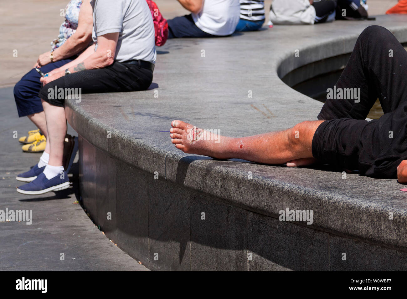 Open Wound High Resolution Stock Photography and Images Alamy